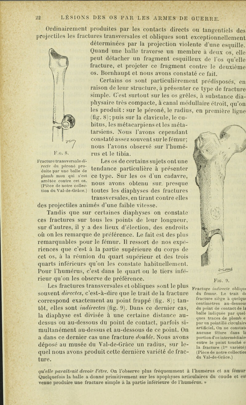 Ordinairement produites par les contacts directs ou tangentiels des projectiles les fractures transversales et obliques sont exceptionnellement déterminées par la projection violente d’une esquille. Quand une balle traverse un membre à deux os, elle peut détacher un fragment esquilleux de l’os quelle fracture, et projeter ce fragment contre le deuxième os. Bornhaupt et nous avons constaté ce fait. Certains os sont particulièrement prédisposés, en raison de leur structure, à présenter ce type de fracture simple. C’est surtout sur les os grêles, à substance dia- physaire très compacte, à canal médullaire étroit, qu’on les produit : sur le péroné, le radius, en première ligne (fig. 8) ; puis sur la clavicule, le cu¬ bitus, les métacarpiens et les méta¬ tarsiens. Nous l’avons cependant constaté assez souvent surle fémur; nous l’avons observé sur l’humé¬ rus et le tibia. Les os de certains sujets ont une tendance particulière à présenter ce type. Sur les os d’un cadavre, nous avons obtenu sur. presque toutes les diaphyses des fractures transversales, en tirant contre elles des projectiles animés d’une faible vitesse. Tandis que sur certaines diaphyses on constate ces fractures sur tous les points de leur longueur, sur d’autres, il y a des lieux d’élection, des endroits où on les remarque de préférence. Le fait est des plus remarquables pour le fémur. Il ressort de nos expé¬ riences que c’est à la partie supérieure du corps de cet os, à la réunion du quart supérieur et des trois quarts inférieurs qu’on les constate habituellement. Pour l’humérus, c’est dans le quart ou le tiers infé¬ rieur qu’on les observe de préférence. Les fractures transversales et obliques sont le plus souvent directes, c’est-à-dire que le trait de la fracture correspond exactement au point frappé (fig. 8); tan¬ tôt, elles sont indirectes (fig. 9). Dans ce dernier cas, la diaphyse est divisée à une certaine distance au- dessus ou au-dessous du point de contact, parfois si¬ multanément au-dessus et au-dessous de ce point. On a dans ce dernier cas une fracture double. Nous avons déposé au musée du Val-de-Grâce un radius, sur le¬ quel nous avons produit cette dernière variété de frac¬ ture. Fracture transversale di¬ recte du péroné pro¬ duite par une balle de plomb mou qui s’est arrêtée contre cet os. (Pièce de notre collec¬ tion du Val-de-Grâce.) Fig. 9. Fracture indirecte oblique du fémur. Le trait de fracture siège à quelque centimètres au-dessous du point de contact de la balle indiquée par quel¬ ques traces de plomb ei par un pointillé circulaire artificiel. On ne constate aucune fêlure dans la portion d’os intermédiair< entre le point touché e la fracture (lre variété) (Pièce de notre collectioi du Val-de-Grâce.) qu'elle paraîtrait devoir l’être. On l’observe plus fréquemment à l’humérus et au fémur, Quelquefois la balle a donné primitivement sur les apophyses articulaires du coude et esl venue produire une fracture simple à la partie inférieure de l’humérus. »