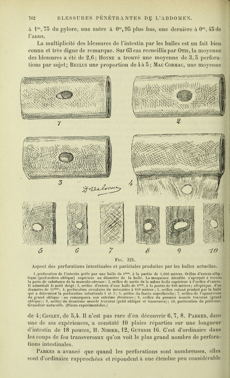 à lm, 75 du pylore, une autre à 0m, 95 plus bas, une dernière à 0m, 45 de l’anus. La multiplicité des blessures de l’intestin par les balles est un fait bien connu et très digne de remarque. Sur 63 cas recueillis par Otis, la moyenne des blessures a été de 2,6 ; Hoyne a trouvé une moyenne de 3, 5 perfora¬ tions par sujet; Reclus une proportion de4à5; Mac Cormac, une moyenne Fig. 321. Aspect des perforations intestinales et pariétales produites par les balles actuelles. 1, perforation de l’intestin grêle par une balle de 8mm, à la portée de 1,000 mètres. Orifice d’entrée ellip¬ tique (perforation oblique) supérieur au diamètre de la balle. La muqueuse décollée s’aperçoit à travers la perte de substance de la musculo-séreuse ; 2, orifice de sortie de la même balle supérieur à l’orifice d’entrée. Il admettait le petit doigt; 3, orifice d’entrée d’une balle de 8mm, à la portée de 800 mètres; elleplique. d’un diamètre de llmm; 4, perforation circulaire du mésentère à 800 mètres ; 5, orifice cutané produit par la balle qui a déterminé la perforation intestinale 1 et 2 ; 6, orifice du fascia superficialis ; 7, orifice de l’aponévrose du grand oblique : on remarquera son extrême étroitesse; 8, orifice du premier muscle traversé (grand oblique); 9, orifice du deuxième muscle traversé (petit oblique et transverse); 10, perforation du péritoine. ■Grandeur naturelle. (Pièces expérimentales.) de 4; Coyley, de 5,4. Il n’est pas rare d’en découvrir 6, 7, 8. Parkes, dans une de ses expériences, a constaté 10 plaies réparties sur une longueur d’intestin de 18 pouces, H. Nimier, 12, Guthrie 16. C’est d’ordinaire dans les coups de feu transversaux qu’on voit le plus grand nombre de perfora¬ tions intestinales. Parkes a avancé que quand les perforations sont nombreuses, elles sont d’ordinaire rapprochées et répondent à une étendue peu considérable