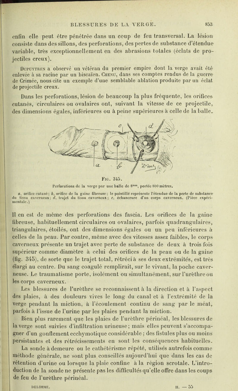 enfin elle peut être pénétrée dans un coup de feu transversal. La lésion consiste dans des sillons, des perforations, des pertes de substance d’étendue- variable, très exceptionnellement en des abrasions totales (éclats de pro¬ jectiles creux). ûupuytren a observé un vétéran du premier empire dont la verge avait été- enlevée à sa racine par un biscaïen. Chenu, dans ses comptes rendus de la guerre l de Crimée, nous cite un exemple d’une semblable ablation produite par un éclat j de projectile creux. Dans les perforations, lésion de beaucoup la plus fréquente, les orifices- cutanés, circulaires ou ovalaires ont, suivant la vitesse de ce projectile, des dimensions égales, inférieures ou à peine supérieures à celle de la balle. Fig. 345. Perforations de la verge par une balle de 8ram, portée 800 mètres. a, orifice cutané; b, orifice de la gaine fibreuse; le pointillé représente l’étendue de la perte de subslanc& du tissu caverneux; d, trajet du tissu caverneux; c, échancrure d’un corps caverneux. (Pièce expéri¬ mentale.) 11 en est de même des perforations des fascia. Les orifices de la gaine fibreuse, habituellement circulaires ou ovalaires, parfois quadrangulaires, triangulaires, étoilés, ont des dimensions égales ou un peu inférieures à celles de la peau. Par contre, môme avec des vitesses assez faibles, le corps caverneux présente un trajet avec perte de substance de deux à trois fois- supérieur comme diamètre à celui des orifices de la peau ou de la gaine (fig. 345), de sorte que le trajet total, rétréci à ses deux extrémités, est très élargi au centre. Du sang coagulé remplirait, sur le vivant, la poche caver¬ neuse. Le traumatisme porte, isolément ou simultanément, sur l’urèthre ou les corps caverneux. Les blessures de l’urèthre se reconnaissent à la direction et à l’aspect des plaies, à des douleurs vives le long du canal et à l’extrémité de la verge pendant la miction, à l’écoulement continu de sang par le méat, | parfois à l’issue de l’urine par les plaies pendant la miction. Bien plus rarement que les plaies de l’urèthre périnéal, les blessures de la verge sont suivies d’infiltration urineuse ; mais elles peuvent s’accompa¬ gner d’un gonflement ecchymotique considérable ; des fistules plus ou moins j persistantes et des rétrécissements en sont les conséquences habituelles. La sonde à demeure ou le cathétérisme répété, utilisés autrefois comme j méthode générale, ne sont plus conseillés aujourd’hui que dans les cas de I rétention d’urine ou lorsque la plaie confine à la région scrotale. L’intro¬ duction de la sonde ne présente pas les difficultés qu’elle offre dans les coups I de feu de l’urèthre périnéal. DELORME. ii. — 55