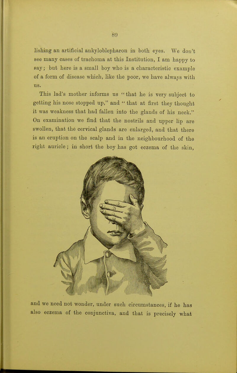 lishing an artificial aukyloblepliaron in both eyes. We don't see many cases of trachoma at this Institution, I am happy to say; but here is a small boy who is a characteristic example of a form of disease which, Hke the poor, we have always with us. This lad's mother informs us that he is very subject to getting his nose stopped up, and  that at first they thought it was weakness that had fallen into the glands of his neck. On examination we find that the nostrils and upper lip are swollen, that the cervical glands are enlarged, and that there is an eruption on the scalp and in the neighbourhood of the right auricle; in short the boy has got eczema of the skin, and we need not wonder, under such circumstances, if he has also eczema of the conjunctiva, and that is precisely what