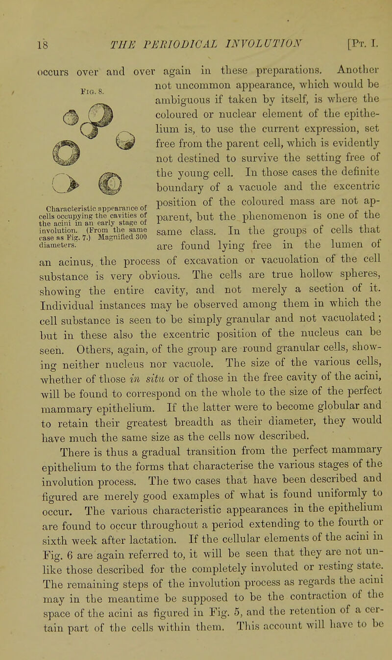 occurs over and over again in these preparations. Another g not uncommon appearance, which would be ambiguous if taken bv itself, is where the coloured or nuclear element of the epithe- lium is, to use the current expression, set free from the parent cell, which is evidently not destined to survive the setting free of the young cell. In those cases the definite boundary of a vacuole and the excentric , position of the coloured mass are not ap- Characteristic nppparance of J- • r xu cells occupying the cavities of -parent, but the phenomenon is one oi the the acini in an early stage of i ' c ii j.i a involution. (From the same game claSS. In the grOUpS OI COiiS tliat case as Fig. 7.) Magnifled 300 n • t ^ c diameters. are found lying free m the lumen oi an acinus, the process of excavation or vacuolation of the cell substance is very obvious. The cells are true hollow spheres, showing the entire cavity, and not merely a section of it. Individual instances may be observed among them in which the cell substance is seen to be simply granular and not vacuolated; but in these also the excentric position of the nucleus can be seen. Others, again, of the group are round granular cells, show- ing neither nucleus nor vacuole. The size of the various cells, whether of those in situ or of those in the free cavity of the acini, will be found to correspond on the whole to the size of the perfect mammary epithelium. If the latter were to become globular and to retain their greatest breadth as their diameter, they would have much the same size as the cells now described. There is thus a gradual transition from the perfect mammary epithelium to the forms that characterise the various stages of the involution process. The two cases that have been described and figured are merely good examples of what is found uniformly to occur. The various characteristic appearances in the epithelium are found to occur throughout a period extending to the fourth or sixth week after lactation. If the cellular elements of the acini in Fig. 6 are again referred to, it will be seen that they are not un- like those described for the completely involuted or resting state. The remaining steps of the involution process as regards the acmi may in the meantime be supposed to be the contraction of the space of the acini as figured in Fig. 5, and the retention of a cer- tain part of the cells within them. This account will have to be