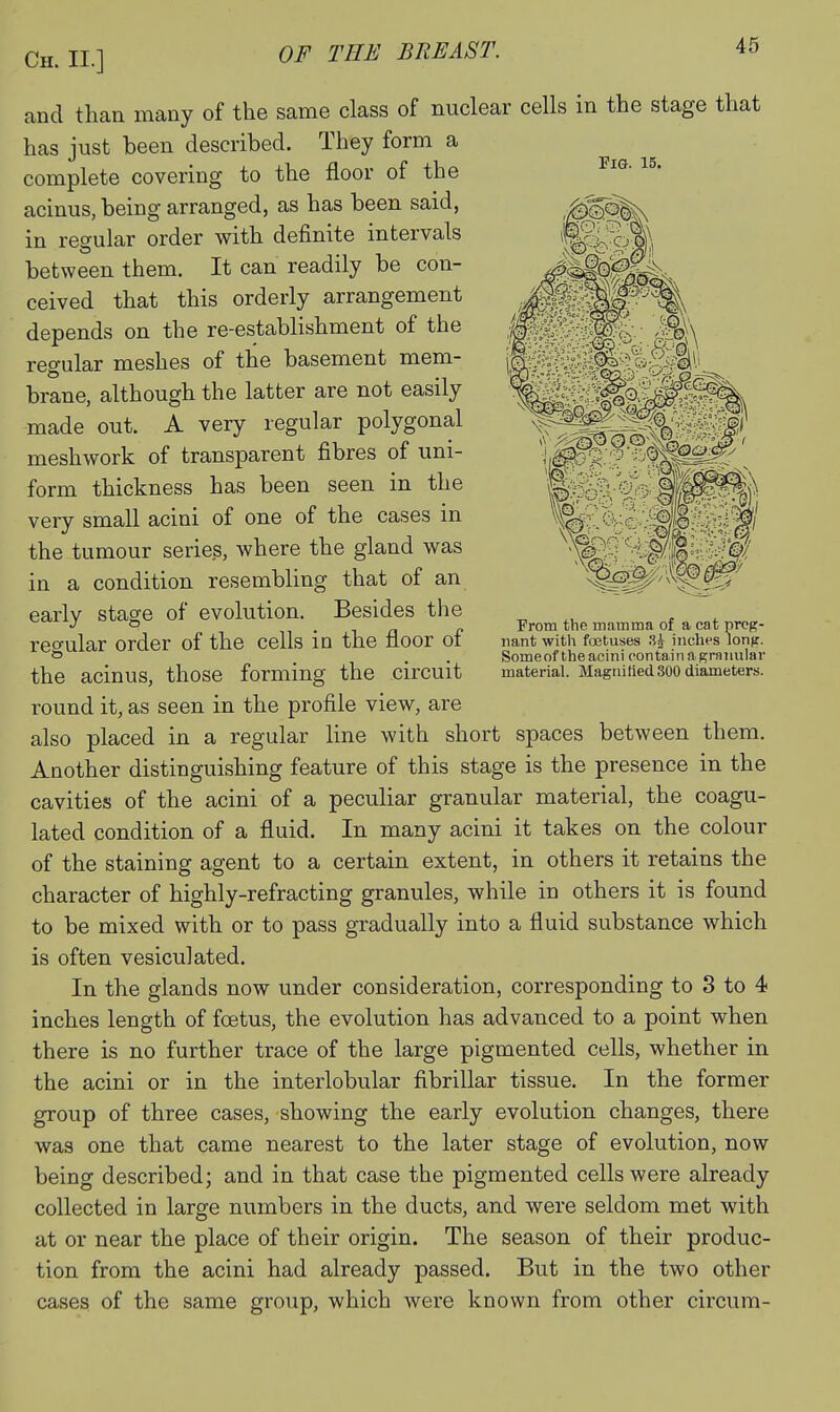 Fig. 15. ,, mm Erom the mamma of a cat preg- nant with tetuses inches lonp. Someof the acini contain a grnnular material. Magtiified 300 diameters. and than many of the same class of nuclear cells in the stage that has just been described. They form a complete covering to the floor of the acinus, being arranged, as has been said, in regular order with definite intervals between them. It can readily be con- ceived that this orderly arrangement depends on the re-establishment of the regular meshes of the basement mem- brane, although the latter are not easily made out. A very regular polygonal meshwork of transparent fibres of uni- form thickness has been seen in the very small acini of one of the cases in the tumour series, where the gland was in a condition resembling that of an early stage of evolution. Besides the reffular order of the cells in the floor of the acinus, those forming the circuit round it, as seen in the profile view, are also placed in a regular line with short spaces between them. Another distinguishing feature of this stage is the presence in the cavities of the acini of a peculiar granular material, the coagu- lated condition of a fluid. In many acini it takes on the colour of the staining agent to a certain extent, in others it retains the character of highly-refracting granules, while in others it is found to be mixed with or to pass gradually into a fluid substance which is often vesiculated. In the glands now under consideration, corresponding to 3 to 4 inches length of foetus, the evolution has advanced to a point when there is no further trace of the large pigmented cells, whether in the acini or in the interlobular fibrillar tissue. In the former group of three cases, showing the early evolution changes, there was one that came nearest to the later stage of evolution, now being described; and in that case the pigmented cells were already collected in large numbers in the ducts, and were seldom met with at or near the place of their origin. The season of their produc- tion from the acini had already passed. But in the two other cases of the same group, which were known from other circum-