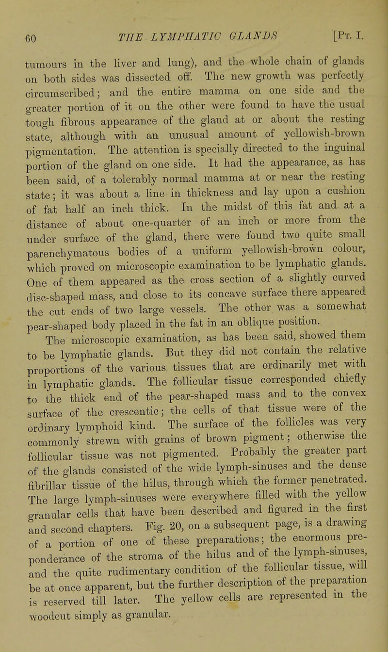 tumours in the liver and lung), and the whole chain of glands on both sides was dissected off. The new growth was perfectly circumscribed; and the entire mamma on one side and the greater portion of it on the other were found to have the usual tough fibrous appearance of the gland at or about the resting state, although with an unusual amount of yellowish-brown pigmentation. The attention is specically directed to the inguinal portion of the gland on one side. It had the appearance, as has been said, of a tolerably normal mamma at or near the resting state; it was about a line in thickness and lay upon a cushion of fat half an inch thick. In the midst of this fat and at a distance of about one-quarter of an inch or more from the under surface of the gland, there were found two quite small parenchymatous bodies of a uniform yellowish-brown colour, which proved on microscopic examination to be lymphatic glands. One of them appeared as the cross section of a slightly curved disc-shaped mass, and close to its concave surface there appeared the cut ends of two large vessels. The other was a somewhat pear-shaped body placed in the fat in an oblique position. The microscopic examination, as has been said, showed them to be Ivmphatic glands. But they did not contain the relative proportions of the various tissues that are ordinarily met with in lymphatic glands. The follicular tissue corresponded chiefly to the thick end of the pear-shaped mass and to the convex surface of the crescentic; the cells of that tissue were of the ordinary lymphoid kind. The surface of the follicles was very commonly strewn with grains of brown pigment; otherwise the follicular tissue was not pigmented. Probably the greater part of the glands consisted of the wide lymph-sinuses and the dense fibrillar tissue of the hilus, through which the former penetrated. The large lymph-sinuses were everywhere filled with the yellow granular cells that have been described and figured in the first and second chapters. Fig. 20, on a subsequent page, is a drawing of a portion of one of these preparations; the enormous pre- ponderance of the stroma of the hilus and of the lymph-smuses and the quite rudimentary condition of the follicular tissue, will be at once apparent, but the further description of the preparation is reserved till later. The yellow cells are represented m the woodcut simply as granular.
