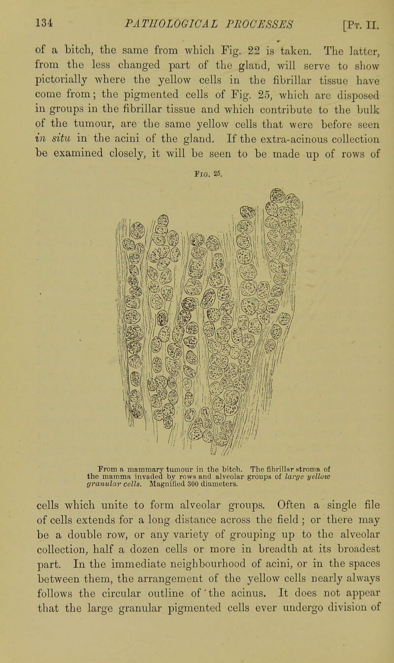 of a bitch, the same from which Fig. 22 is taken. The latter, from the less changed part of the gland, will serve to show pictorially where the yellow cells in the fibrillar tissue have come from; the pigmented cells of Fig. 25, which arc disposed in groups in the fibrillar tissue and which contribute to the bulk of the tumour, are the same yellow cells that were before seen in situ in the acini of the gland. If the extra-acinous collection be examined closely, it will be seen to be made up of rows of Fig. 25. From a mammary tumour in the bitch. The fibrillHr stroma of the mamma invaded by rows and alveolar groups of large yellow granular cells. Magnified 300 diameters. cells which unite to form alveolar groups. Often a single file of cells extends for a long distance across the field ; or there may be a double row, or any variety of grouping up to the alveolar collection, half a dozen cells or more in breadth at its broadest part. In the immediate neighbourhood of acini, or in the spaces between them, the arrangement of the yellow cells nearly always follows the circular outline of' the acinus. It does not appear that the large granular pigmented cells ever undergo division of