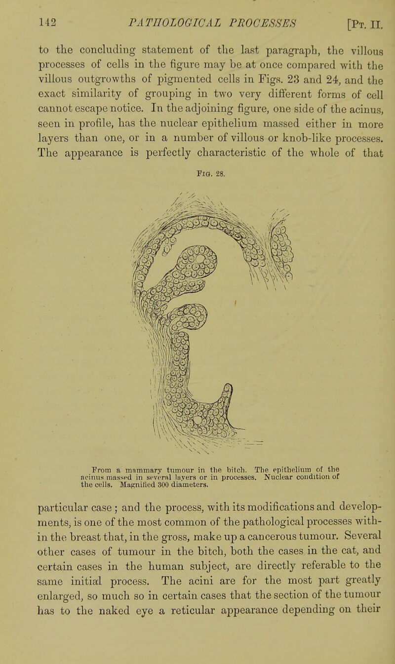 to the concluding statement of the last paragraph, the villous processes of cells in the figure may be at once compared with the villous outgrowths of pigmented cells in Figs. 23 and 24, and the exact similarity of grouping in two very different forms of cell cannot escape notice. In the adjoining figure, one side of the acinus, seen in profile, has the nuclear epithelium massed either in more layers than one, or in a number of villous or knob-like processes. The appearance is perfectly characteristic of the whole of that Pig. 28. Prom a mammary tumour in the bitch. The epithelium of the neinus massed in several layers or in processes. Nuclear condition of the cells. MaRnifled 300 diameters. particular case ; and the process, with its modifications and develop- ments, is one of the most common of the pathological processes with- in the breast that, in the gross, make up a cancerous tumour. Several other cases of tumour in the bitch, both the cases in the cat, and certain cases in the human subject, are directly referable to the same initial process. The acini are for the most part greatly enlarged, so much so in certain cases that the section of the tumour has to the naked eye a reticular appearance depending on their
