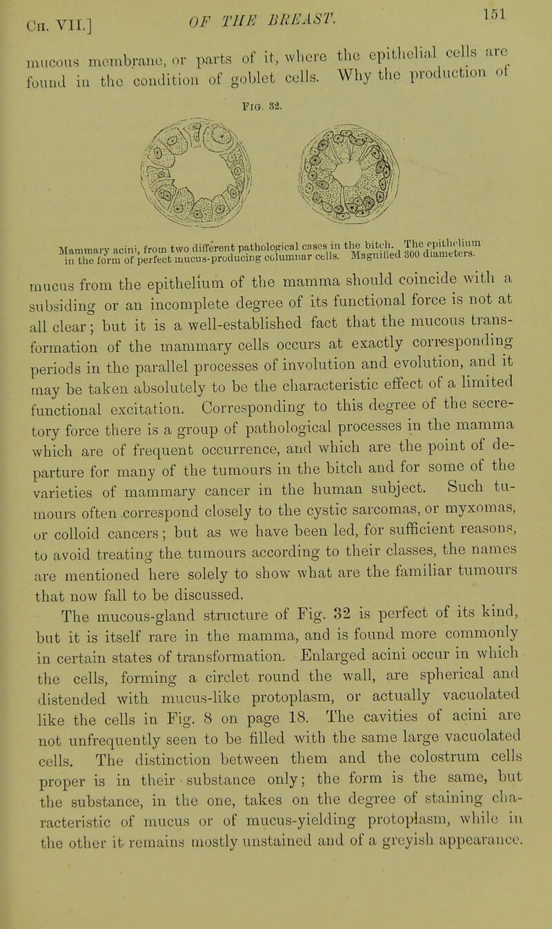 mucous moiubrauc, or parts of it, where the epithelial cells are found iu the coiulition of goblet cells. Why the production of Via. 82. 0^ Mammary acini, from two difTerent pathological cases i^n the bitch Tli^B ''pa^^^^^ ill the form of perfect mucus-producmg columnar cells. Magnihed 300 ttiamettrs. mucus from the epithelium of the mamma should coincide with a subsiding or an incomplete degree of its functional force is not at all clear° but it is a well-established fact that the mucous trans- formation of the mammary cells occurs at exactly corresponding periods in the parallel processes of involution and evolution, and it may be taken absolutely to be the characteristic effect of a hmited functional excitation. Corresponding to this degree of the secre- tory force there is a group of pathological processes in the mamma which are of frequent occurrence, and which are the point of de- parture for many of the tumours in the bitch and for some of the varieties of mammary cancer in the human subject. Such tu- mours often correspond closely to the cystic sarcomas, or myxomas, or colloid cancers; but as we have been led, for sufficient reasons, to avoid treating the tumours according to their classes, the names are mentioned here solely to show what are the familiar tumours that now fall to be discussed. The mucous-gland stracture of Fig. 82 is perfect of its kind, but it is itself rare in the mamma, and is found more commonly in certain states of transformation. Enlarged acini occur in which the cells, forming a circlet round the wall, are spherical and distended with mucus-like protoplasm, or actually vacuolated like the cells in Fig. 8 on page 18. The cavities of acini are not unfrequently seen to be filled with the same large vacuolated cells. The distinction between them and the colostrum cells proper is in their substance only; the form is the same, but the substance, iu the one, takes on the degree of staining cha- racteristic of mucus or of mucus-yielding protoplasm, while iu the other it remains mostly unstained and of a greyish appearance.