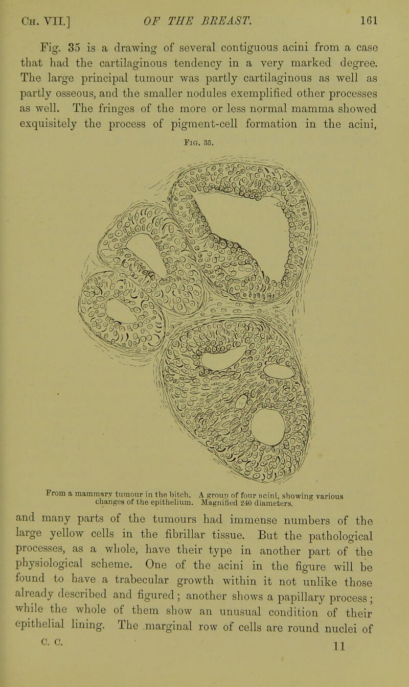 Fig. 35 is a drawing of several contiguous acini from a case that had the cartilaginous tendency in a very marked degree. The large principal tumour was partly cartilaginous as well as partly osseous, and the smaller nodules exemplified other processes as well. The fringes of the more or less normal mamma showed exquisitely the process of pigment-cell formation in the acini, Fig. 85. From a mammary tumour in the bitch. A group of four acini, showing various changes of the epithelium. Magnifled 240 diameters. and many parts of the tumours had immense numbers of the large yellow cells in the fibrillar tissue. But the pathological processes, as a whole, have their type in another part of the physiological scheme. One of the acini in the figure will be found to have a trabecular growth within it not unlike those already described and figured ; another shows a papillary process ; while the whole of them show an unusual condition of their epithelial lining. The marginal row of cells are round nuclei of