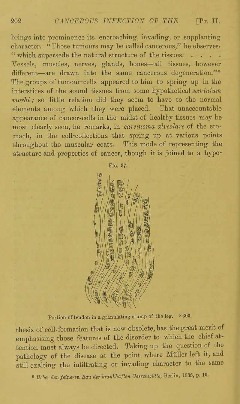 brings into prominence its encroaching, invading, or supplanting character. Those tumours may be called cancerous/' lie observes^ which supersede the natural structure of the tissues Vessels, muscles, nerves, glands, bones—all tissues, however different—are drawn into the same cancerous degeneration.* The groups of tumour-cells appeared to him to spring up in the interstices of the sound tissues from some hypothetical seminium morhi; so little relation did they seem to have to the normal elements among which they were placed. That unaccountable appearance of cancer-cells in the midst of healthy tissues may be most clearly seen, he remarks, in carcinoma alveolare of the sto- mach, in the cell-collections that spring up at various points throughout the muscular coats. This mode of representing the structure and properties of cancer, though it is joined to a hypo- FiG. 37. Portion of tendon in a granulating stnmp of the leg. x 300. thesis of cell-formation that is now obsolete, has the great merit of emphasising those features of the disorder to which the chief at- tention must always be directed. Taking up the question of the pathology of the disease at the point where Miiller left it, and still exalting the infiltrating or invading character to the same * Ueber denfeineren Ban der kran'k'haften QessclmUlte, Berlin, 1838, p. 10.