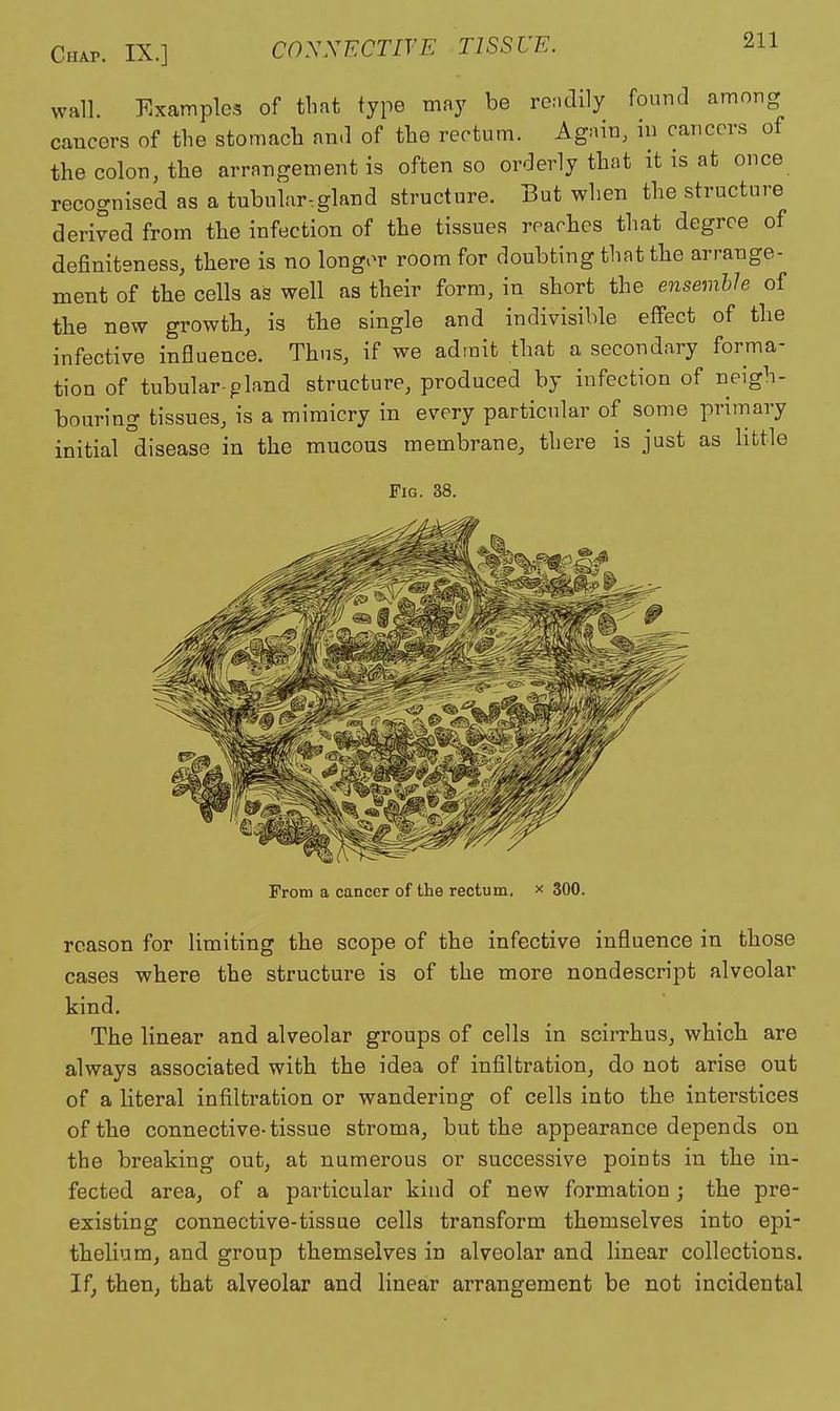 wall. Examples of that type may be rcndily found among cancers of the stomach and of the rectum. Again, in cancers of the colon, the arrangement is often so orderly that it is at once recognised as a tubular.gland structure. But when the structure derived from the infection of the tissues reaches that degree of definiteness, there is no longor room for doubting that the arrange- ment of the cells as well as their form, in short the ensemble of the new growth, is the single and indivisible effect of the infective influence. Thus, if we admit that a secondary forma- tion of tubular-pland structure, produced by infection of neigh- bouring tissues, is a mimicry in every particular of some primary initial disease in the mucous membrane, there is just as little Fig. 38. From a cancer of the rectum, x 300. reason for limiting the scope of the infective influence in those cases where the structure is of the more nondescript alveolar kind. The linear and alveolar groups of cells in scirrhus, which are always associated with the idea of infiltration, do not arise out of a literal infiltration or wandering of cells into the interstices of the connective-tissue stroma, but the appearance depends on the breaking out, at numerous or successive points in the in- fected area, of a particular kind of new formation ; the pre- existing connective-tissue cells transform themselves into epi- thelium, and group themselves in alveolar and linear collections. If, then, that alveolar and linear arrangement be not incidental