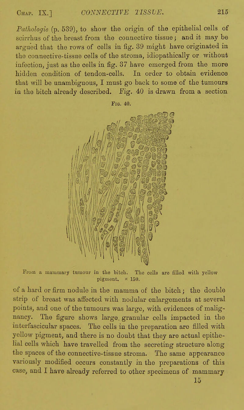 Palhologie (p. 539), to show the origin of the epithelial cells of scin-hus of the breast from the connective tissue; and it may be argued that the rows of cells in fig. 39 might have originated in the connective-tissue cells of the stroma, idiopathically or without infection, just as the cells in fig. 37 have emerged from the more hidden condition of tendon-cells. In order to obtain evidence that will be unambiguous, I must go back to some of the tumours in the bitch already described. Fig. 40 is drawn from a section Fig. 40. From a mammary tumour in tlie bitch. The cells are filled with yellow pigment, x 150. of a hard or firm nodule in the mamma of the bitch; the double strip of breast was aSected with nodular enlargements at several points, and one of the tumours was large, with evidences of malig- nancy. The figure shows large, granular cells impacted in the interfascicular spaces. The cells in the preparation are filled with yellow pigment, and there is no doubt that they are actual epithe- lial cells which have travelled from the secreting structure along the spaces of the connective-tissue stroma. The same appearance variously modified occurs constantly in the preparations of this case, and I have already referred to other specimens of mammary