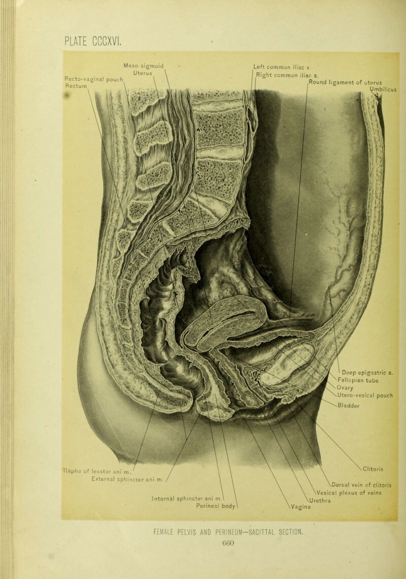 Recto-vaginal pouch Rectum Meso-sigmoid Uterus Left common iliac v. Right common iliac a. Round ligament of uterus Umbilicus Deep epigastric a. Fallcplan tube Ovary Utero-vesical pouch Bladder 1?aphe of levator ani ni External sphincter ani m, / Internal sphincter ani m Perineal body Clitoris Dorsal vein of clitoris \Vesical plexus of veins Urethra Vagina FEMALE PELVIS AND PERINEUM-SAGITTAL SECTION, GOO