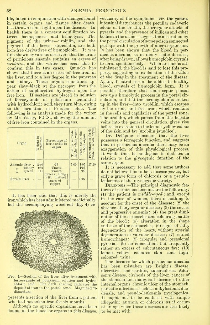 life, taken in conjunction with changes found in certain organs and tissues after death, has thrown some light upon the disease. In health there is a constant equilibration be- tween haernogenesis and hemolysis. The pigment of the urine—irrobilin, and the pigment of the faeces—stercobilin, are both iron-free derivatives of haemoglobin. It was first shown by various observers that the urine of pernicious anaemia contains an excess of urobilin, and the writer has been able to confirm this in two cases. Quincke has shown that there is an excess of free iron in the liver, and to a less degree in the pancreas and kidney. These organs sometimes ap- pear slaty-black at the necropsy, from the action of sulphuretted hydrogen upon the free iron. If sections are placed in solution of ferrocyanide of potassium acidulated with hydrochloric acid, they turn blue, owing to the formation of Prussian blue. The following is an analysis made for the writer by Mr. Vasey, F.C.S., showing the amount of free iron contained in the organs. It has been said that this is merely the iron which has been administered medicinally, but the accompanying wood-cut (fig. 4) re- Fig. 4.—Section of the liver after treatment with ferrocyanide of potassium solution and hydro- chloric acid. The dark shading indicates the deposit of iron in the portal zone. Magnified 75 diameters. presents a section of the liver from a patient who had not taken iron for six months. Although no specific organisms have been found in the blood or organs in this disease, yet many of the symptoms—viz. the gastro- intestinal disturbances, the peculiar cadaveric odour of the breath, the irregular attacks of pyrexia, and tbe presence of indican and other bodies in the urine—suggest the absorption by the portal circulation of some poison connected perhaps with the growth of micro-organisms. It has been shown that the blood in per- nicious anaemia, as in many septic diseases, after being drawn, allows haemoglobin crystals to form spontaneously. When arsenic is ad- ministered, the blood is said to lose this pro- perty, suggesting an explanation of the value of the drug in the treatment of the disease. Again, if putrid serum be added to healthy blood, crystals of haemoglobin form. It is possible therefore that some septic poison sets up a haemolytic process in the portal cir- culation, and that the haemoglobin is broken up in the liver—into urobilin, which escapes by the urine, and free iron, which remains in the cells and capillaries of the portal zone. The urobilin, which passes from the hepatic veins into the general circulation, gives rise before its excretion to the lemon-yellow colour of the skin and fat (urobilin jaundice). Dr. Delepine considers that the liver possesses a ferrogenic function, and suggests that in pernicious anaemia there may be an exaggeration of this physiological process. It would thus be analogous to diabetes in relation to the glycogenic function of the same organ. It is necessary to add that some authors do not believe this to be a disease per se, but only a grave form of chlorosis or a pseudo- leukaemia of the myelogenic variety. Diagnosis.—The principal diagnostic fea- tures of pernicious anaemia are the following : (1) the patient is middle-aged; and, except in the case of women, there is nothing to account for the onset of the disease; (2) the absence of any organic disease ; (3) the severe and progressive anaemia; (4) the great dimi- nution of the corpuscles and colouring matter of the blood: (5) alteration in the shape and size of the corpuscles ; (6) signs of fatty degeneration of the heart, without arterial degeneration or valvular disease ; (7) retinal haemorrhages; (8) irregular and occasional pyrexia; (9) no emaciation, but frequently rather an excess of subcutaneous fat; (10) lemon - yellow coloured skin and high- coloured urine. The diseases for Avhich pernicious anaemia has been mistaken are Bright's disease, ulcerative endocarditis, tuberculosis, Addi- son's disease, cirrhosis of the liver, cancer of the stomach and malignant disease of other internal organs, chronic ulcer of the stomach, parasitic affections, such as ankylostoma duo- denale, and pseudo-leukaemia myelogenica. It ought not to be confused with simple idiopathic anaemia or chlorosis, as it occurs at an age when these diseases are less likely to be met with. Organ Anasmic liver . „ kidney „ spleen Normal liver . 3 S 1240 282 141 Percentage of ferric oxide in organ •29 Traces Traces Traces; along) with distinct traces o£ copper 3-60 c3^ 1-05 1-25 •90 1-16 27-2H