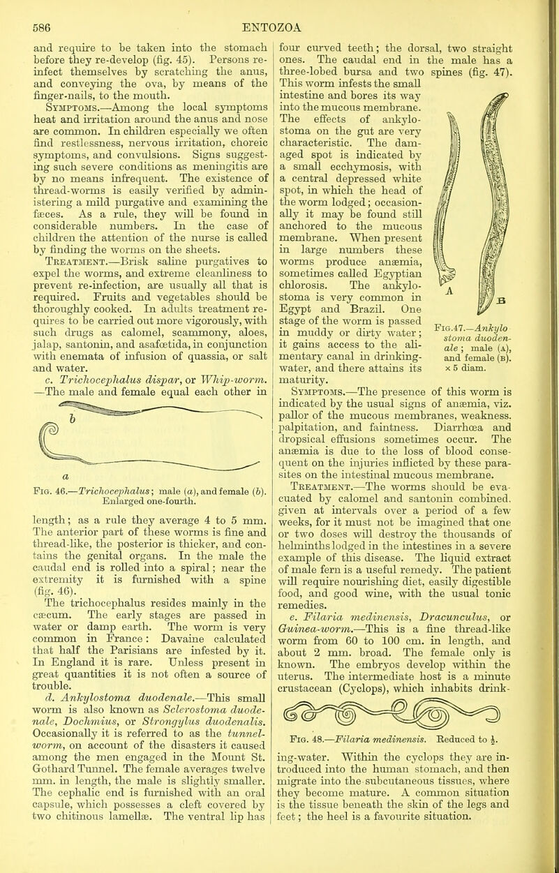 and require to be taken into the stomach before they re-develop (fig. 45). Persons re- infect themselves by scratching the anus, and conveying the ova, by means of the finger-nails, to the mouth. Symptoms.—Among the local symptoms heat and irritation around the anus and nose are common. In children especially we often find restlessness, nervous irritation, choreic symptoms, and convulsions. Signs suggest- ing such severe conditions as meningitis are by no means infrequent. The existence of thread-worms is easily verified by admin- istering a mild purgative and examining the faeces. As a rule, they will be found in considerable numbers. In the case of children the attention of the nurse is called by finding the worms on the sheets. Treatment.—Brisk saline purgatives to expel the worms, and extreme cleanliness to prevent re-infection, are usually all that is required. Fruits and vegetables should be thoroughly cooked. In adults treatment re- quires to be carried out more vigorously, with such drugs as calomel, scammony, aloes, jalap, santonin, and asafoetida, in conjunction with enemata of infusion of quassia, or salt and water. c. Trichocephalus dispar, or Whip-worm. —The male and female equal each other in Fig. 46.—Trichocephalus; male (a), and female (6). Enlarged one-fourth. length; as a rule they average 4 to 5 mm. The anterior part of these worms is fine and thread-like, the posterior is thicker, and con- tains the genital organs. In the male the caudal end is rolled into a spiral; near the extremity it is furnished with a spine (fig. 46). The trichocephalus resides mainly in the caecum. The early stages are passed in water or damp earth. The worm is very common in France: Davaine calculated that half the Parisians are infested by it. In England it is rare. Unless present in great quantities it is not often a source of trouble. d. Arikylostoma duodenale.—This small worm is also known as Sclerostoma duode- nale, Dochmius, or Strongylus duodenalis. Occasionally it is referred to as the tunnel- worm, on account of the disasters it caused among the men engaged in the Mount St. Gothard Tunnel. The female averages twelve mm. in length, the male is slightly smaller. The cephalic end is furnished with an oral capsule, which possesses a cleft covered by two chitinous lamellae. The ventral lip has Fig.47.—Ankylo stoma duoden- ale ; male (a), and female (b). x 5 diam. four curved teeth; the dorsal, two straight ones. The caudal end in the male has a three-lobed bursa and two spines (fig. 47). This worm infests the small intestine and bores its way into the mucous membrane. The effects of ankylo- stoma on the gut are very characteristic. The dam- aged spot is indicated by a small ecchymosis, with a central depressed white spot, in which the head of the worm lodged; occasion- ally it may be found still anchored to the mucous membrane. When present in large numbers these worms produce anaemia, sometimes called Egyptian chlorosis. The ankylo- stoma is very common in Egypt and Brazil. One stage of the worm is passed in muddy or dirty water; it gains access to the ali- mentary canal in drinking- water, and there attains its maturity. Symptoms.—The presence of this worm is indicated by the usual signs of anaemia, viz. pallor of the mucous membranes, weakness, palpitation, and faintness. Diarrhoea and dropsical effusions sometimes occur. The anaemia is due to the loss of blood conse- quent on the injuries inflicted by these para- sites on the intestinal mucous membrane. Treatment.—The worms should be eva- cuated by calomel and santonin combined, given at intervals over a period of a few weeks, for it must not be imagined that one or two doses will destroy the thousands of helminths lodged in the intestines in a severe example of this disease. The liquid extract of male fern is a useful remedy. The patient will require nourishing diet, easily digestible food, and good wine, with the usual tonic remedies. e. Filaria medinensis, Dracunculus, or Guinea-worm.—This is a fine thread-like worm from 60 to 100 cm. in length, and about 2 mm. broad. The female only is known. The embryos develop within the uterus. The intermediate host is a minute crustacean (Cyclops), which inhabits drink- Fig. 48.—Filaria medinensis. Eeduced to J. ing-water. Within the cyclops they are in- troduced into the human stomach, and then migrate into the subcutaneous tissues, where they become mature. A common situation is the tissue beneath the skin of the legs and feet; the heel is a favourite situation.