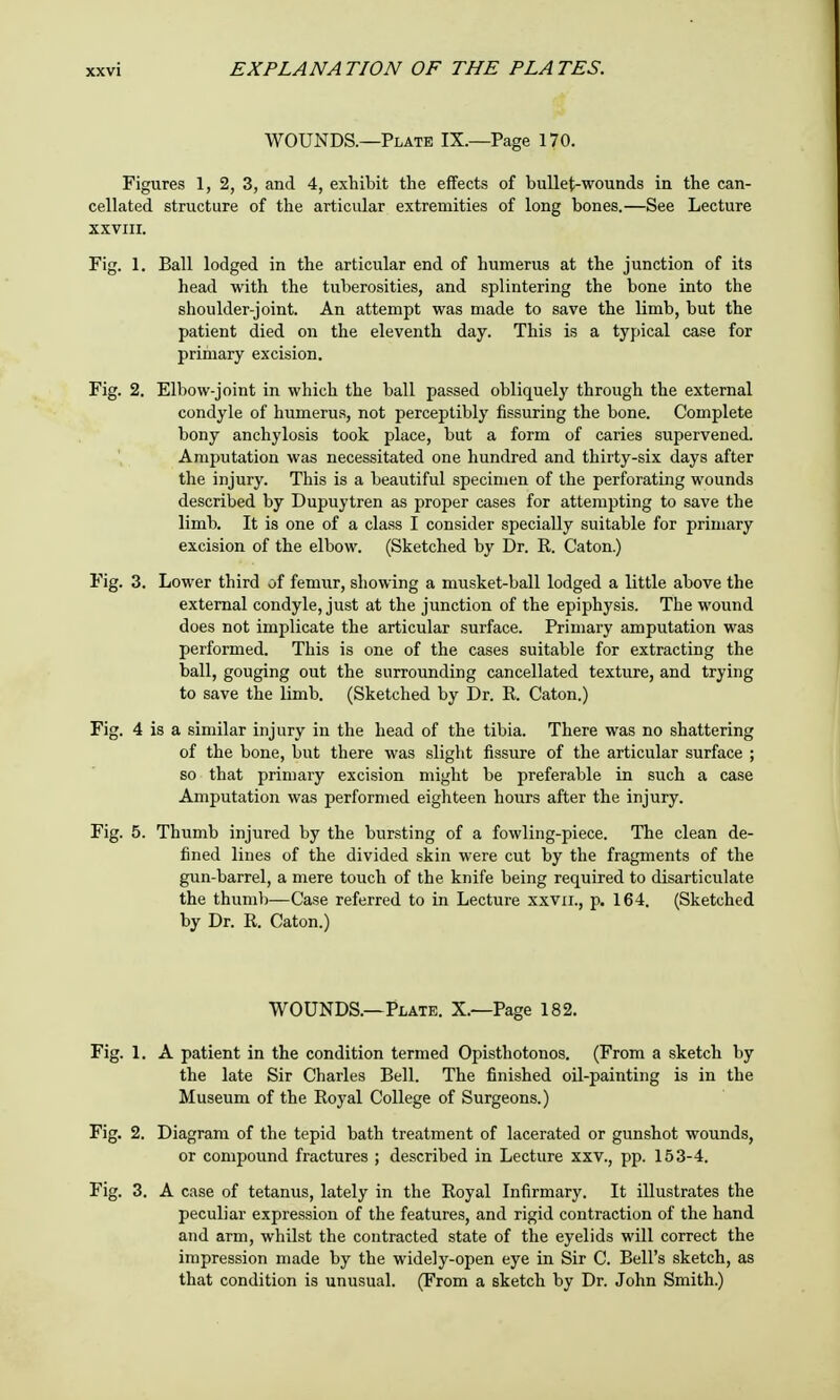 WOUNDS.—Plate IX.—Page 170. Figures 1, 2, 3, and 4, exhibit the effects of bullet-wounds in the can- cellated structure of the articular extremities of long bones.—See Lecture XXVIII. Fig. 1. Ball lodged in the articular end of humerus at the junction of its head with the tuberosities, and splintering the bone into the shoulder-joint. An attempt was made to save the limb, but the patient died on the eleventh day. This is a typical case for primary excision. Fig. 2. Elbow-joint in which the ball passed obliquely through the external condyle of humerus, not perceptibly Assuring the bone. Complete bony anchylosis took place, but a form of caries supervened. Amputation was necessitated one hundred and thirty-six days after the injury. This is a beautiful specimen of the perforating wounds described by Dupuytren as proper cases for attempting to save the limb. It is one of a class I consider specially suitable for primary excision of the elbow. (Sketched by Dr. R. Caton.) Fig. 3. Lower third of femur, showing a musket-ball lodged a little above the external condyle, just at the junction of the epiphysis. The wound does not implicate the articular surface. Primary amputation was performed. This is one of the cases suitable for extracting the ball, gouging out the surrounding cancellated texture, and trying to save the limb. (Sketched by Dr. R. Caton.) Fig. 4 is a similar injury in the head of the tibia. There was no shattering of the bone, but there was slight fissure of the articular surface ; so that primary excision might be preferable in such a case Amputation was performed eighteen hours after the injury. Fig. 5. Thumb injured by the bursting of a fowling-piece. The clean de- fined lines of the divided skin were cut by the fragments of the gun-barrel, a mere touch of the knife being required to disarticulate the thumb—Case referred to in Lecture xxvu., p. 164. (Sketched by Dr. R. Caton.) WOUNDS.—Plate. X.—Page 182. Fig. 1. A patient in the condition termed Opisthotonos. (From a sketch by the late Sir Charles Bell. The finished oil-painting is in the Museum of the Royal College of Surgeons.) Fig. 2. Diagram of the tepid bath treatment of lacerated or gunshot wounds, or compound fractures ; described in Lecture xxv., pp. 153-4. Fig. 3. A case of tetanus, lately in the Royal Infirmary. It illustrates the peculiar expression of the features, and rigid contraction of the hand and arm, whilst the contracted state of the eyelids will correct the impression made by the widely-open eye in Sir C. Bell's sketch, as that condition is unusual. (From a sketch by Dr. John Smith.)