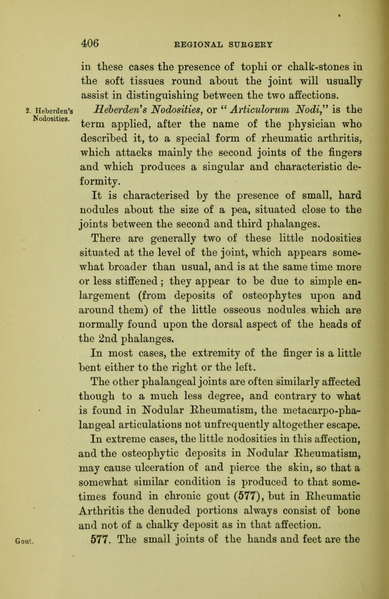 in these cases the presence of tophi or chalk-stones in the soft tissues round about the joint will usually assist in distinguishing between the two affections. 2. Heberden's Heberden's Nodosities, or  Articulorum Nodi is the Nodosities. ^erm appijg^ after the name of the physician who described it, to a special form of rheumatic arthritis, which attacks mainly the second joints of the fingers and which produces a singular and characteristic de- formity. It is characterised by the presence of small, hard nodules about the size of a pea, situated close to the joints between the second and third phalanges. There are generally two of these little nodosities situated at the level of the joint, which appears some- what broader than usual, and is at the same time more or less stiffened; they appear to be due to simple en- largement (from deposits of osteophytes upon and around them) of the little osseous nodules which are normally found upon the dorsal aspect of the heads of the 2nd phalanges. In most cases, the extremity of the finger is a little bent either to the right or the left. The other phalangeal joints are often similarly affected though to a much less degree, and contrary to what is found in Nodular Eheumatism, the metacarpo-pha- langeal articulations not unfrequently altogether escape. In extreme cases, the little nodosities in this affection, and the osteophytic deposits in Nodular Eheumatism, may cause ulceration of and pierce the skin, so that a somewhat similar condition is produced to that some- times found in chronic gout (577), but in Eheumatic Arthritis the denuded portions always consist of bone and not of a chalky deposit as in that affection. Gout. 577. The small joints of the hands and feet are the