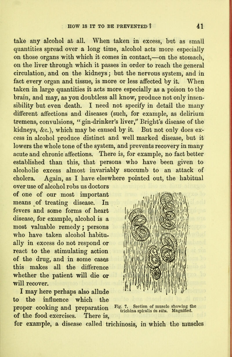 take any alcohol at all. When taken in excess, but as small quantities spread over a long time, alcohol acts more especially on those organs with which it comes in contact,—on the stomach, on the liver through which it passes in order to reach the general circulation, and on the kidneys; but the nervous system, and in fact every organ and tissue, is more or less affected by it. When taken in large quantities it acts more especially as a poison to the brain, and may, as you doubtless all know, produce not only insen- sibility but even death. I need not specify in detail the many dijBPerent affections and diseases (such, for example, as delirium tremens, convulsions, gin-drinker's liver,'' Bright's disease of the kidneys, &c.), which may be caused by it. But not only does ex- cess in alcohol produce distinct and well marked disease, but it lowers the whole tone of the system, and prevents recovery in many acute and chronic affections. There is, for example, no fact better established than this, that persons who have been given to alcoholic excess almost invariably succumb to an attack of cholera. Again, as I have elsewhere pointed out^ the habitual over use of alcohol robs us doctors of one of our most important means of treating disease. In fevers and some forms of heart disease, for example, alcohol is a most valuable remedy; persons who have taken alcohol habitu- ally in excess do not respond or react to the stimulating action of the drug, and in some cases this makes all the difference whether the patient will die or will recover. I may here perhaps also allude to the influence which the proper cooking and preparation of the food exercises. There is, for example, a disease called trichinosis, in which the muscles Fig. 7. Section of muscle sliowing the trichina spiralis in situ. Magnified.