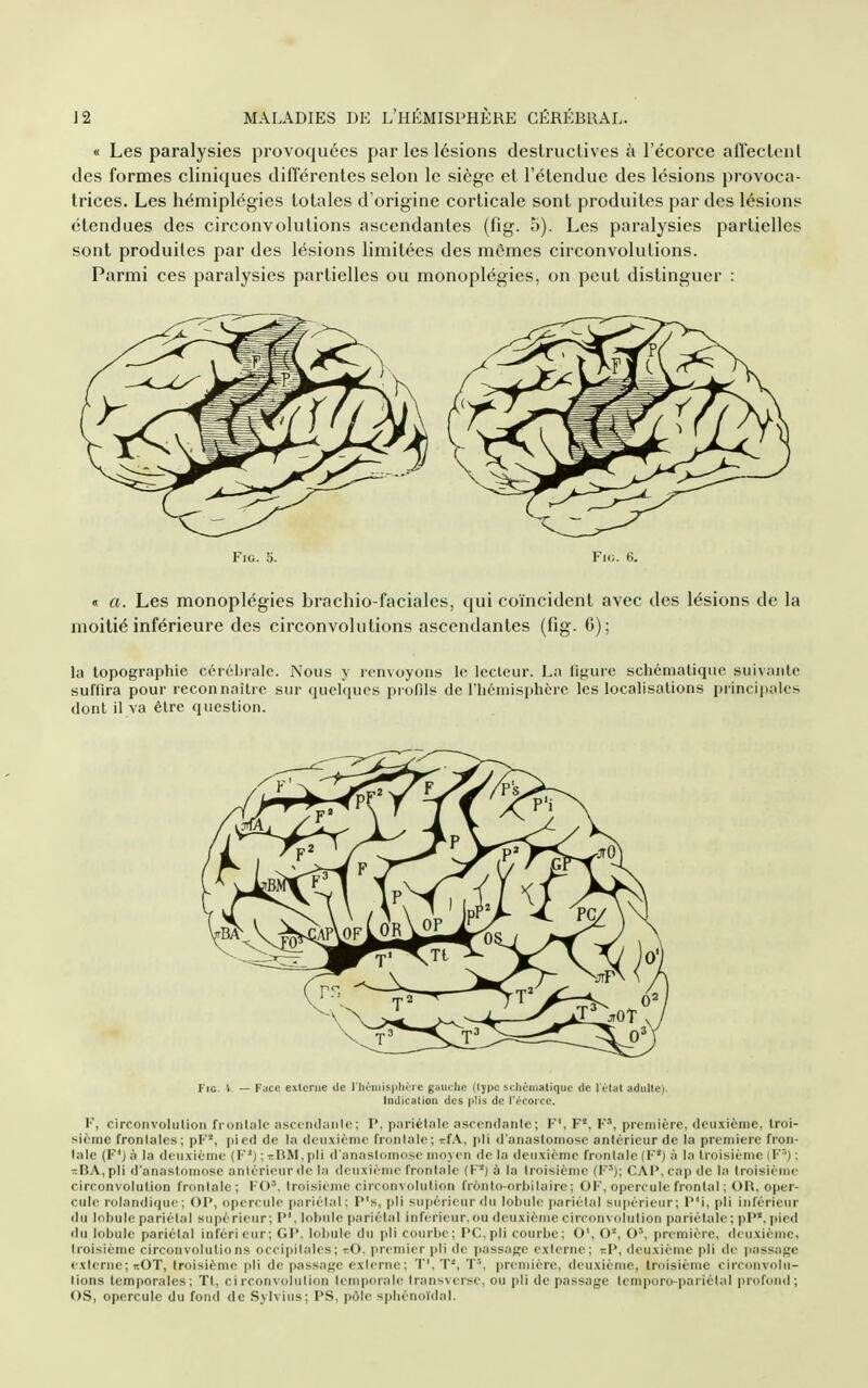 « Les paralysies provoquées par les lésions deslrucUves à l'écorce aiïecleiil des formes cliniques différentes selon le siège et l'étendue des lésions provoca- trices. Les hémiplégies totales d'origine corticale sont produites par des lésions étendues des circonvolutions ascendantes (fig. 5). Les paralysies partielles sont produites par des lésions limitées des mêmes circonvolutions. Parmi ces paralysies partielles ou monoplégies, on peut distinguer : Fig. 5. Vu,. (!. « a. Les monoplégies brachio-faciales, qui coïncident avec des lésions de la moitié inférieure des circonvolutions ascendantes (fig. 0); la topographie cérchralc. Nous y renvoyons le lecteur. La figure schématique suivante suffira pour reconnaître sur quelques profils de l'hémisphère les localisations principales dont il va être question. Fie. 't, — Face exlenie Je riiùniisplii j e gaui lie (lype schùiiiatiquc de IVlal aduUe). Indication des plis de l'écoi'cc. l', circonvolution fi onl;ile ;iscon<l;inlc ; V, pariétale ascendante; F', F*, F', première, (Icu.xièmc, Iroi- sième frontales; pi'*, [lied de l;i (leiixiénie frontale; r.fA, pli d'anasloiiiose antérieur de la première fron- tale (F'j à la deiixiènie ( F-) : rBM, pli d'anasloniosc moven de la deiixiènic frontale (F*) à la troisième ( F') ; -BA.pli d'anastomose anièrieiir (le la deuxième frontale (F*) à la troisième (F'J; CAI*,cap de la troisième circonvolution frontale; FO', troisième circonvolution frônto-orbilairc; OF, opercule frontal ; Oïl, oper- cule rolandi(|ue ; OV, opercule parièlal: P's, pli supérieur du lobule pariétal sii|iérieur; P'i, pli inférieur du lobule pariétal s iipé rieur : I*'. lobule pariétal inférieur, ou deuxième circoin idution pariétale ; pied du lobule pariétal inférieur; Gl'. Udiule du pli courbe; l'C.pli courbe; O', O*, ()', première, <leuxièmc, troisième circonvolutions occipitales; rO, premier pli de passage externe; t.V, deuxième pli de passage externe; i:OT, troisième pli de passage exierue; T', T*, T^, première, deuxième, troisième circonvolu- tions temporales; Tt, circonvolution lem|)orale transversc. ou pli de passage Icmporo-iiariètal profond; OS, opercule du fond de Sylvius; PS, pôle si)liénoïdal.