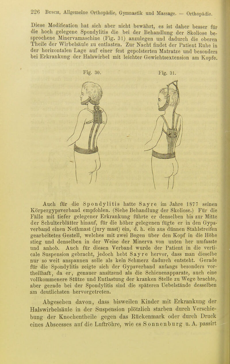 Diese Modification liat sicli aber nicht bewährt, es ist daher besser für die hoch gelegene Spondylitis die bei der Behandlung der Skoliose be- sprochene Minervamaschine (Fig. 31) anzulegen und dadurch die oberen Theile der Wirbelsäule zu entlasten. Zur Nacht findet der Patient Ruhe in der horizontalen Lage auf einer fest gepolsterten Matratze und besonders bei Erkrankung der Halswirbel mit leichter Gewichtsextension am Kopfe. Auch für die Spondylitis hatte Sayre im Jahre 1877 seinen Körpergypsverband empfohlen. (Siehe Behandlung der Skoliose.) Für die Fälle mit tiefer gelegener Erkrankung führte er denselben bis zur Mitte der Schulterblätter hinauf, für die höher gelegenen fügte er in den Gyps- verband einen Nothmast (jury mast) ein, d. h. ein aus dünnen Stahlstreifen gearbeitetes Gestell, welches mit zwei Bogen über den Kopf in die Höhe stieg und denselben in der Weise der Minerva von unten her umfasste und anhob. Auch für diesen Verband wurde der Patient in die verti- cale Suspension gebracht, jedoch hebt Sayre hervor, dass man dieselbe nur so weit anspannen solle als kein Schmerz dadurch entsteht. Gerade für die Spondylitis zeigte sich der Gypsverband anfangs besonders vor- theilhaft, da er, genauer ansitzend als die Schienenapparate, auch eine vollkommenere Stütze und Entlastung der kranken Stelle zu Wege brachte, aber gerade bei der Spondylitis sind die späteren Uebelstände desselben am deutlichsten hervorgetreten. Abgesehen davon, dass bisweilen Kinder mit Erkrankung der Halswirbelsäule in der Suspension plötzlich starben durch Verschie- bung der Knochentheile gegen das Rückenmark oder durch Druck eines Abscesses auf die Luftröhre, wie es Sonnenburg u. A. passirt Fig. 30. Fig. 31.