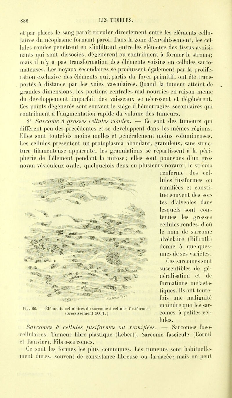 et par places le sang parait circuler directement entre les éléments cellu- laires du néoplasme formant paroi. Dans la zone d'envahissement, les cel- lules rondes pénètrent en s'infîltrant entre les éléments des tissus avoisi- nants qui sont dissociés, dégénèrent ou contribuent à former le stroma; mais il n'y a pas transformation des éléments voisins en cellules sarco- mateuses. Les noyaux secondaires se produisent également par la prolifé- ration exclusive des éléments qui, partis du foyer primitif, ont été trans- portés à distance par les voies vasculaires. Quand la tumeur atteint de grandes dimensions, les portions centrales mal nourries en raison même du développement imparfait des vaisseaux se nécrosent et dégénèrent. Ces points dégénérés sont souvent le siège d'hémorragies secondaires qui contribuent à l'augmentation rapide du volume des tumeurs. 2° Sarcome à grosses cellules rondes. — Ce sont des tumeurs qui diffèrent peu des précédentes et se développent dans les mêmes régions. Elles sont toutefois moins molles et généralement moins volumineuses. Les cellules présentent un protoplasma abondant, granuleux, sans struc- ture filamenteuse apparente, les granulations se répartissent à la péri- phérie de l'élément pendant la mitose; elles sont pourvues d'un gros noyau vésiculeux ovale, quelquefois deux ou plusieurs noyaux; le stroma renferme des cel- . s & ^ • Iules fusiformes ou ^ -C ramifiées et consti- « , , . tue souvent des sor- s —- ^ j tes d'alvéoles dans ?S „ lesquels sont con- . tenues les grosses ^ A s ~ cellules rondes, d'où «g£ -^sfe- ~ ^^i''© r' &% le nom de sarcome ^ .^.^V ®. ^ ■ • ® ^ g* alvéolaire (Billroth) ^ >7?} 9 * ^ © Fii donné à quelques- ' * ç, ^ ® • unes de ses variétés. % ^ . © ^ - Ces sarcomes sont ^ ® ^ & ' ^ •--> susceptibles de gé- ;v;; ^^J^'..*3^ - néralisation et de ^ * formations métasta- ^ tiques. Ils ont toute- ■/l.~l<Àm*s'<' fois une malignité t.. «„ „ , . . „ , „ moindre que les sar- Fig. 66. — Eléments cellulaires du sarcome a cellules fusiformes. A (Grossissement 500/1.) COIUCS à petites Cel- iules. Sarcomes à cellules fusiformes ou ramifiées. — Sarcomes fuso- cellulaires. Tumeur fibro-plastique (Lcbert). Sarcome fasciculé (Cornil et Ranvier). Fibro-sarcomes. Ce sont les formes les plus communes. Les tumeurs sont habituelle- ment dures, souvent de consistance fibreuse ou lardacée; mais on peut