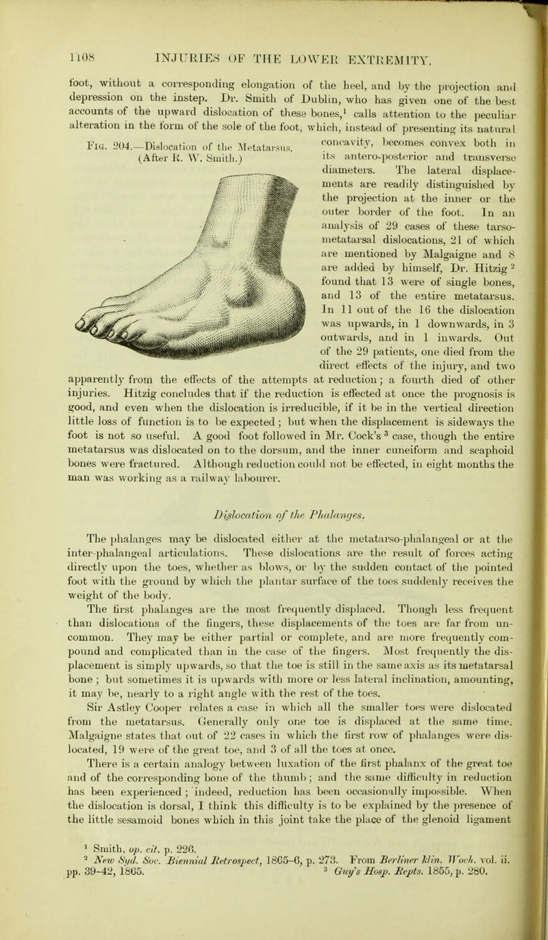 toot, without a corresponding elongation of the heel, and by the projection and depression on the instep. Dr. Smith of Dublin, who has given one of the best accounts of the upward dislocation of these bones,1 calls attention to the peculiar alteration in the form of the sole of the foot, which, instead of presenting its natura I Fia. 204.-Dislocation of the Metatarsus. concavity, becomes convex both in (After R. W. Smith.) lls antero-posterior and transverse diameters. The lateral displace- ments are readily distinguished by the projection at the inner or the outer boi'der of the foot. In an analysis of 29 cases of these tarso- metatarsal dislocations, 21 of which are mentioned by Malgaigne and 8 are added by himself, Dr. Hitzig 2 found that 13 were of single bones, and 13 of the entire metatarsus. In 11 out of the 16 the dislocation was upwards, in 1 downwards, in 3 outwards, and in 1 inwards. Out of the 29 patients, one died from the direct effects of the injury, and two apparently from the effects of the attempts at reduction; a fourth died of other injuries. Hitzig concludes that if the reduction is effected at once the prognosis is good, and even when the dislocation is irreducible, if it be in the vertical direction little loss of function is to be expected ; but when the displacement is sideways the foot is not so useful. A good foot followed in Mr. Cock's 3 case, though the entire metatarsus was dislocated on to the dorsum, and the inner cuneiform and scaphoid bones were fractured. Although reduction could not be effected, in eight months the man was working as a railway labourer. Dislocation of the Phalanges. The phalanges may be dislocated either at the metatarso-phalangeal or at the inter-phalangeal articulations. These dislocations are the result of forces acting directly upon the toes, whether as blows, or by the sudden contact of the pointed foot with the ground by which the plantar surface of the toes suddenly receives the weight of the body. The first phalanges are the most frequently displaced. Though less frequent than dislocations of the fingers, these displacements of the toes are far from un- common. They may be either partial or complete, and are more frequently com- pound and complicated than in the case of the fingers. Most frequently the dis- placement is simply upwards, so that the toe is still in the same axis as its metatarsal bone ; but sometimes it is upwards with more or less lateral inclination, amounting, it may be, nearly to a right angle with the rest of the toes. Sir Astley Cooper relates a case in which all the smaller toes were dislocated from the metatarsus. Generally only one toe is displaced at the same time. Malgaigne states that out of 22 cases in which the first row of phalanges were dis- located, 19 were of the great toe, and 3 of all the toes at once. There is a certain analogy between luxation of the first phalanx of the great toe and of the corresponding bone of the thumb; and the same difficulty in reduction has been experienced ; indeed, reduction has been occasionally impossible. When the dislocation is dorsal, I think this difficulty is to be explained by the presence of the little sesamoid bones which in this joint take the place of the glenoid ligament 1 Smith, op. cif. p. 220. 3 New Syd. &oc. Biennial Retrospect, 1805-0, p. 27.'?. From Berliner khn. Woch. vol. ii. pp. 39-42, 1865. 3 Guy's Mosj>. Kepts. 1855, p. 280.