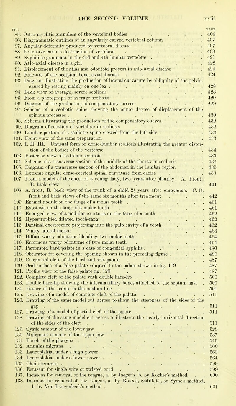 FIR. PAGE 85. Osteomyelitis granulosa of the vertebral bodies ..... 404 86. Diagrammatic outlines of an angularly curved vertebral column . . . 407 87. Angular deformity produced by vertebral disease ..... 407 88. Extensive carious destruction of vertebrae . . . . . 408 89. Syphilitic gummata in the 3rd and 4th lumbar vertebra .... 421 90. Atlo-axial disease in a girl . . . . . . . . 422 91. Displacement of the atlas and odontoid process in atlo-axial disease . . 424 92. Fracture of the occipital bone, axial disease . . . . . . 424 93. Diagram illustrating the production of lateral curvature by obliquity of the pelvis, caused by resting mainly on one leg . . . •. . . . 428 94. Back view of average, severe scoliosis ...... 428 95. From a photograph of average scoliosis . . . . . . 429 96. Diagram of the production of compensatory curves .... 429 97. Scheme of a scoliotic spine, showing the minor degree of displacement of the spinous processes ......... 430 98. Scheme illustrating the production of the compensatory curves . . . 432 99. Diagram of rotation of vertebrae in scoliosis . . . . 432 100. Lumbar portion of a scoliotic spine viewed from the left side . . . . 433 101. Front view of the same preparation ...... 433 102. I. II. III. Unusual form of dorso-lumbar scoliosis illustrating the greater distor- tion of the bodies of the vertebras ...... 434 103. Posterior view of extreme scoliosis . . . . . . . 435 104. Scheme of a transverse section of the middle of the thorax in scoliosis . . 436 105. Diagram of a transverse section of the abdomen in the lumbar region . . 436 106. Extreme angular dorso-cervical spinal curvature from caries . . . 439 107. From a model of the chest of a young lady, two years after pleurisy. A. Front; B. back view . . . . . . . . . 441 108. A. front, B. back view of the trunk of a child 2£ years after empysema. 0. D. front and back views of the same six months after treatment . . . 442 109. Enamel nodule on the fangs of a molar tooth . . . . . 461 110. Exostosis on the fang of a molar tooth ...... 461 111. Enlarged view of a nodular exostosis on the fang of a tooth , . . 462 112. Hypertrophied dilated tooth-fang ....... 462 113. Dentinal excrescence projecting into the pulp cavity of a tooth . . . 462 114. Warty lateral incisor ........ 463 115. Diffuse warty odontome blending two molar teeth . . . . . 464 116. Enormous warty odontome of two molar teeth ..... 464 117. Perforated hard palate in a case of congenital syphilis . . . . . 486 118. Obturator for covering the opening shown in the preceding figure . . . 486 119. Congenital cleft of the hard and soft palate . . . . . 487 120. Oral surface of a false palate adapted to the palate shown in fig. 119 . . 487 121. Profile view of the false palate fig. 120 . . . . . 487 122. Complete cleft of the palate with double hare-lip ..... 500 123. Double hare-lip showing the intermaxillary bones attached to the septum nasi . 500 124. Fissure of the palate in the median line. ....... 501 125. Drawing of a model of complete cleft of the palate . . . . . 511 126. Drawing of the same model cut across to show the steepness of the sides of the gap ........... 511 127. Drawing of a model of partial cleft of the palate . . . . .511 128. Drawing of the same model cut across to illustrate the nearly horizontal direction of the sides of the cleft . . . ... . . . 511 129. Cystic tumour of the lower jaw . . . . . . . 528 130. Malignant tumour of the upper jaw ...... 537 131. Pouch of the pharynx ......... 546 132. Annulus migrans ......... 560 133. Leucoplakia, under a high power . . . . . . . 563 134. Leucoplakia, under a lower power ....... 564 135. Chain ecraseur .......... 599 136. Ecraseur for single wire or twisted cord ...... 599 137. Incisions for removal of the tongue, a. by Jaeger's, b. by Kocher's method . . 600 138. Incisions for removal of the tongue, a. by Roux's, Sedillot's, or Syme's method, b. by Von Langenbeck's method ....... 601