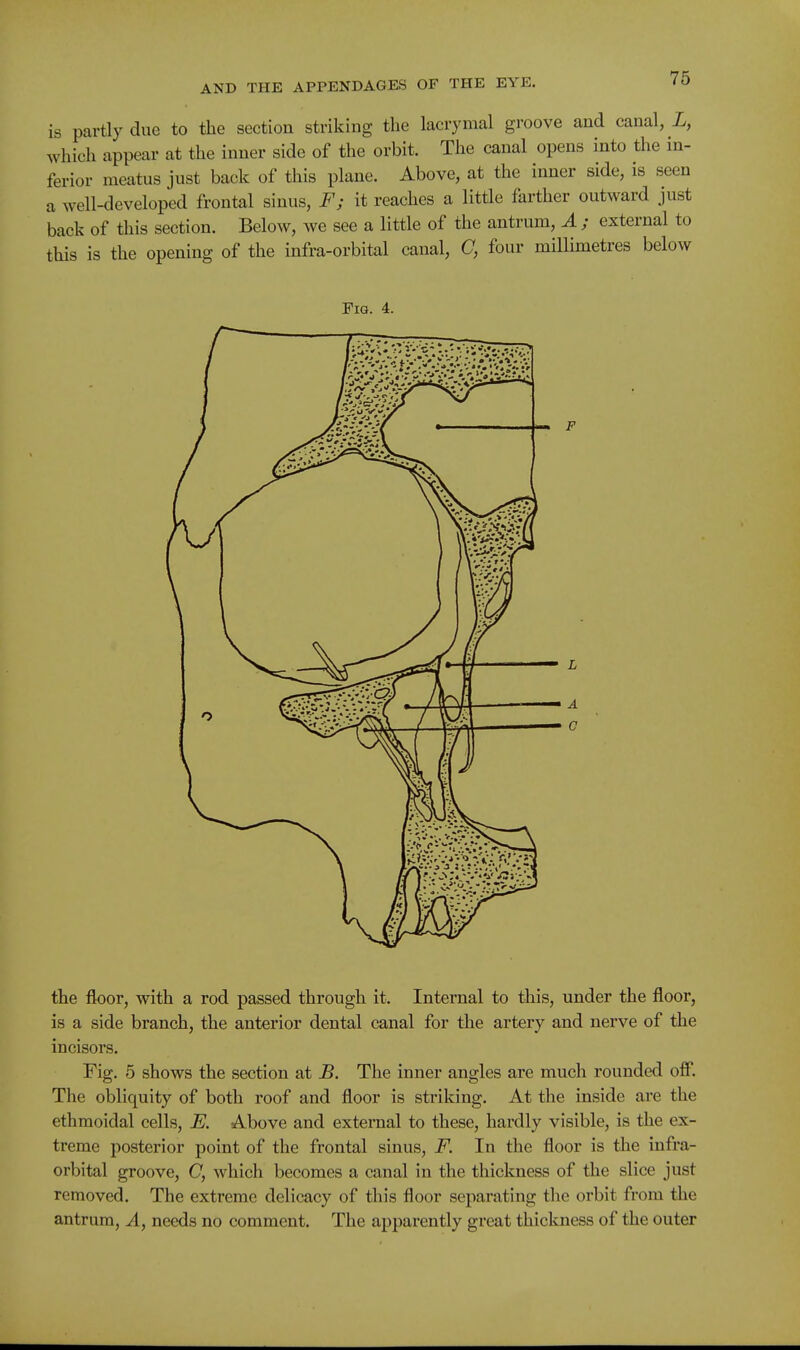 is partly due to the section striking the lacrymal groove and canal, i, which appear at the inner side of the orbit. The canal opens into the in- ferior meatus just back of this plane. Above, at the inner side, is seen a well-developed frontal sinus, F; it reaches a little farther outward just back of this section. Below, we see a little of the antrum, A ; external to this is the opening of the infra-orbital canal, C, four millimetres below Fig. 4. A C the floor, with a rod passed through it. Internal to this, under the floor, is a side branch, the anterior dental canal for the artery and nerve of the incisors. Fig. 5 shows the section at B. The inner angles are mucli rounded off. The obliquity of both roof and floor is striking. At the inside are the ethmoidal cells, E. Above and external to these, hardly visible, is the ex- treme posterior point of the frontal sinus, F. In the floor is the infra- orbital groove, C, which becomes a canal in the thickness of the slice just removed. The extreme delicacy of this floor separating the orbit from the antrum. A, needs no comment. The apparently great thickness of the outer