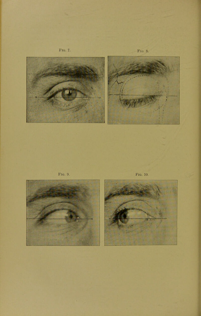 Fig. 9. Fig. 10.