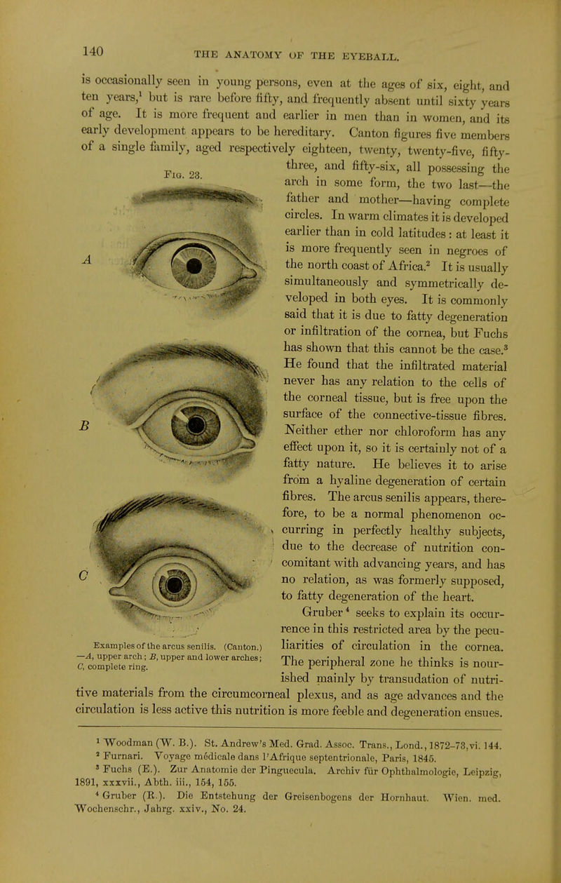 Fig. 28. is occasionally seen in young persons, even at the ages of six, eight, and ten years,^ but is rare before fifty, and frequently absent until sixty years of age. It is more frequent and earlier in men than in women, and its early development appears to be hereditary. Canton figures five members of a single family, aged respectively eighteen, twenty, twenty-five, fifty- three, and fifty-six, all possessing the arch in some form, the two last—the father and mother—having complete circles. In warm climates it is developed earlier than in cold latitudes: at least it is more frequently seen in negroes of the north coast of Africa. It is usually simultaneously and symmetrically de- veloped in both eyes. It is commonly said that it is due to fatty degeneration or infiltration of the cornea, but Fuchs has shown that this cannot be the case.^ He found that the infiltrated material never has any relation to the cells of the corneal tissue, but is free upon the surface of the connective-tissue fibres. Neither ether nor chloroform has any effect upon it, so it is certainly not of a fatty nature. He believes it to arise from a hyaline degeneration of certain fibres. The arcus senilis appears, there- fore, to be a normal phenomenon oc- curring in perfectly healthy subjects, due to the decrease of nutrition con- comitant with advancing years, and has no relation, as was formerly supposed, to fatty degeneration of the heart. Gruber * seeks to explain its occur- rence in this restricted area by the pecu- liarities of circulation in the cornea. The peripheral zone he thinks is nour- ished mainly by transudation of nutri- tive materials from the circumcorneal plexus, and as age advances and the circulation is less active this nutrition is more feeble and degeneration ensues. B Examples of the arcus senilis. (Canton.) —A, upper arch; B, upper and lower arches; C, complete ring. 1 Woodman (W. B.). St. Andrew's Med. Grad. Assoc. Trans., Lond., 1872-73,vi. 144. » Furnari. Yoyage medicale dans I'Afrique septentrionale, Paris, 1845. ' Fuchs (E.). Zur Anatomic der Pinguecula. Archiv fiir Ophthalmologie, Leipzig, 1891, xxxvii., Abth. iii., 154, 155. * Gruber (K.). Die Entstchung der Greisenbogens der Hornhaut. Wien. mod. Wochenschr., Jahrg. xxiv., No. 24.
