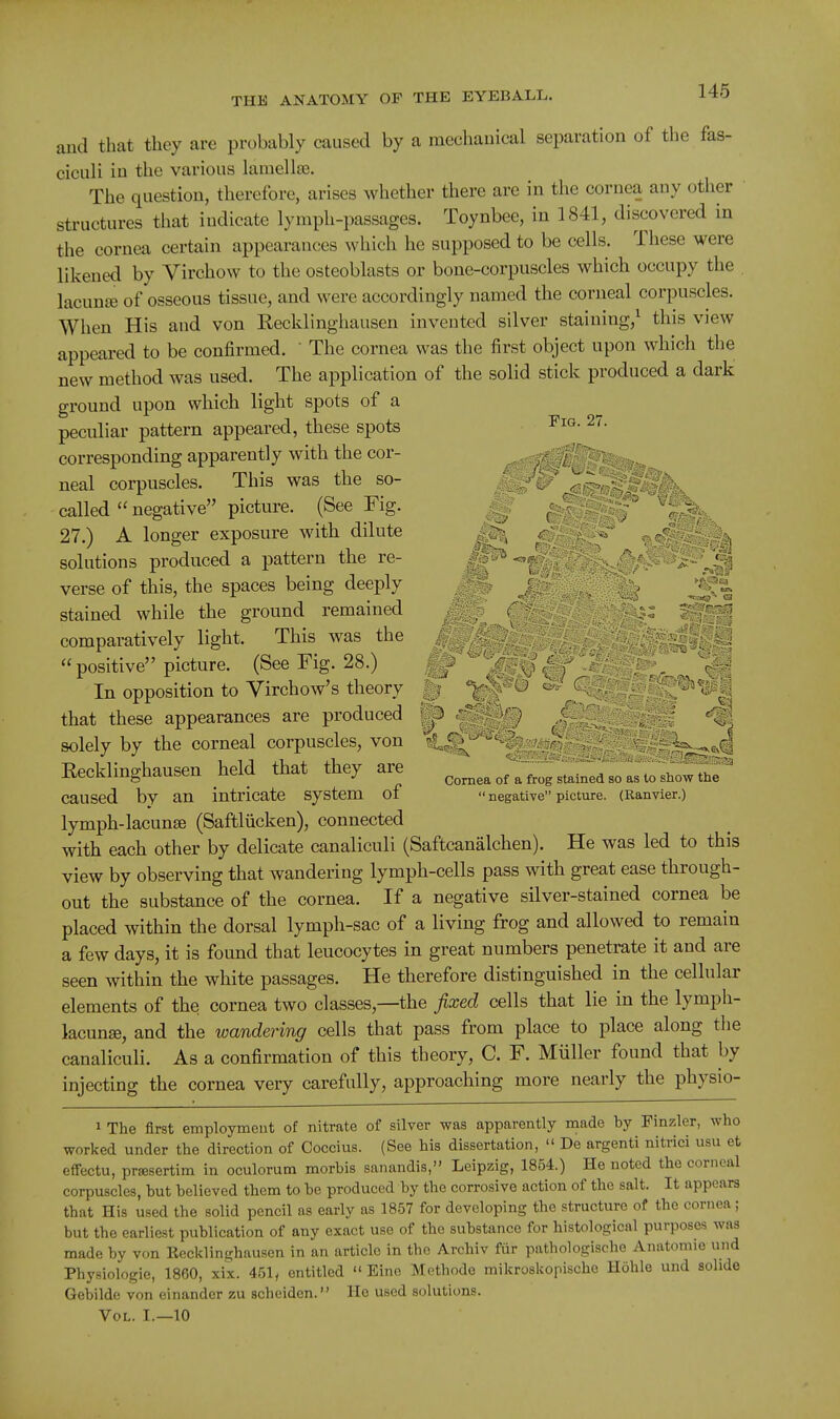 and that they are probably caused by a mechanical separation of the fas- ciculi in the various lamellse. The question, therefore, arises whether there are in the cornea any other sU-uctures that indicate lymph-passages. Toynbee, in 1841, discovered in the cornea certain appearances which he supposed to be cells. These were likened by Virchow to the osteoblasts or bone-corpuscles which occupy the lacunffi of osseous tissue, and were accordingly named the corneal corpuscles. When His and von Recklinghausen invented silver staining,^ this view appeared to be confirmed.  The cornea was the first object upon which the new method was used. The application of the solid stick produced a dark ground upon which light spots of a peculiar pattern appeared, these spots 27- corresponding apparently with the cor- -,--0f^^^p-,.,^^^ neal corpuscles. This was the so- /.^^^ . -^^^ called negative picture. (See Fig. ^ ^ ;' %-1^) , 27.) A longer exposure with dilute ^ 0: solutions produced a pattern the re- verse of this, the spaces being deeply ^ j '' ,g stained while the ground remained /  — - comparatively light. This was the ■  positive picture. (See Fig. 28.) ' . y IS In opposition to Virchow's theory § '^-O e^^C that these appearances are produced ^ . solely by the corneal corpuscles, von C^^'%^fe . . - : Recklmghausen held that they are Cornea of a frog stained so as to show the ~ caused bv an intricate system of  Begative picture. (Ranvier.) lymph-lacunse (Saftliicken), connected with each other by delicate canaliculi (Saftcanalchen). He was led to this view by observing that wandering lymph-cells pass with great ease through- out the substance of the cornea. If a negative silver-stained cornea be placed within the dorsal lymph-sac of a living frog and allowed to remain a few days, it is found that leucocytes in great numbers penetrate it and are seen within the white passages. He therefore distinguished in the cellular elements of the cornea two classes,—the fixed cells that lie in the lymph- lacunse, and the wandering cells that pass from place to place along the canaliculi. As a confirmation of this theory, C. F. Miiller found that by injecting the cornea very carefully, approaching more nearly the physio- 1 The first employment of nitrate of silver was apparently made by Finzler, who worked under the direction of Coccius. (See his dissertation,  De argenti nitrici usu et effectu, prffisertim in oculorum morbis sanandis, Leipzig, 1854.) He noted the corneal corpuscles, but believed them to be produced by the corrosive action of the salt. It appears that His used the solid pencil as early as 1857 for developing the structure of the cornea; but the earliest publication of any exact use of the substance for histological purposes was made by von Recklinghausen in an article in the Archiv fiir pathologische Anatomic und Physiologic, 1860, xix. 451, entitled  Eine Mothodo mikroskopische Hohle und solide Gebilde von einander zu scheiden. He used solutions. Vol. I.—10