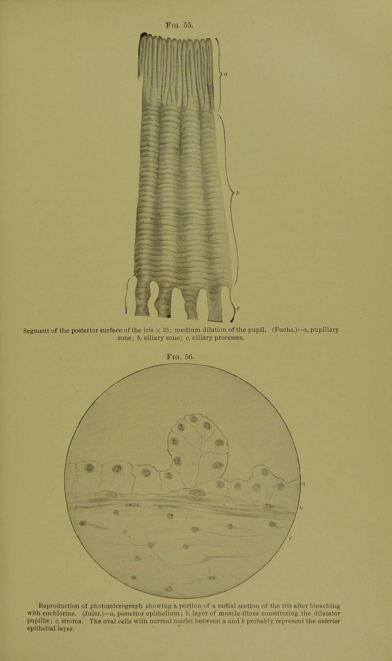 / Segment of the posterior surface of the iris X 25; medium dilation of the pupil. (Fuchs.)—a, pupillary zone; b, ciliary zone; c, ciliary processes. Pig. 56. Reproduction of photomicrograph showing a portion of a riidinl section of the iris after bleaching with euchlorlne. (Juler.)—a, posterior epithelium; /), layer of muscle-fibres constituting tlie dilatator pupillse; c, stroma. The oval cells with normal nuclei between a and b probably represent the anlerior epithelial layer.