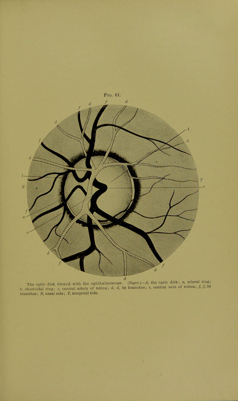 The optic disk viewed with the ophthalmoscope. (Jager.)-/1, the optic disk; a, s h. chorioidal ring; c, central artery of retina; d, d, its branches; e, central vein of ret branches; N, nasal side; T, temporal side.