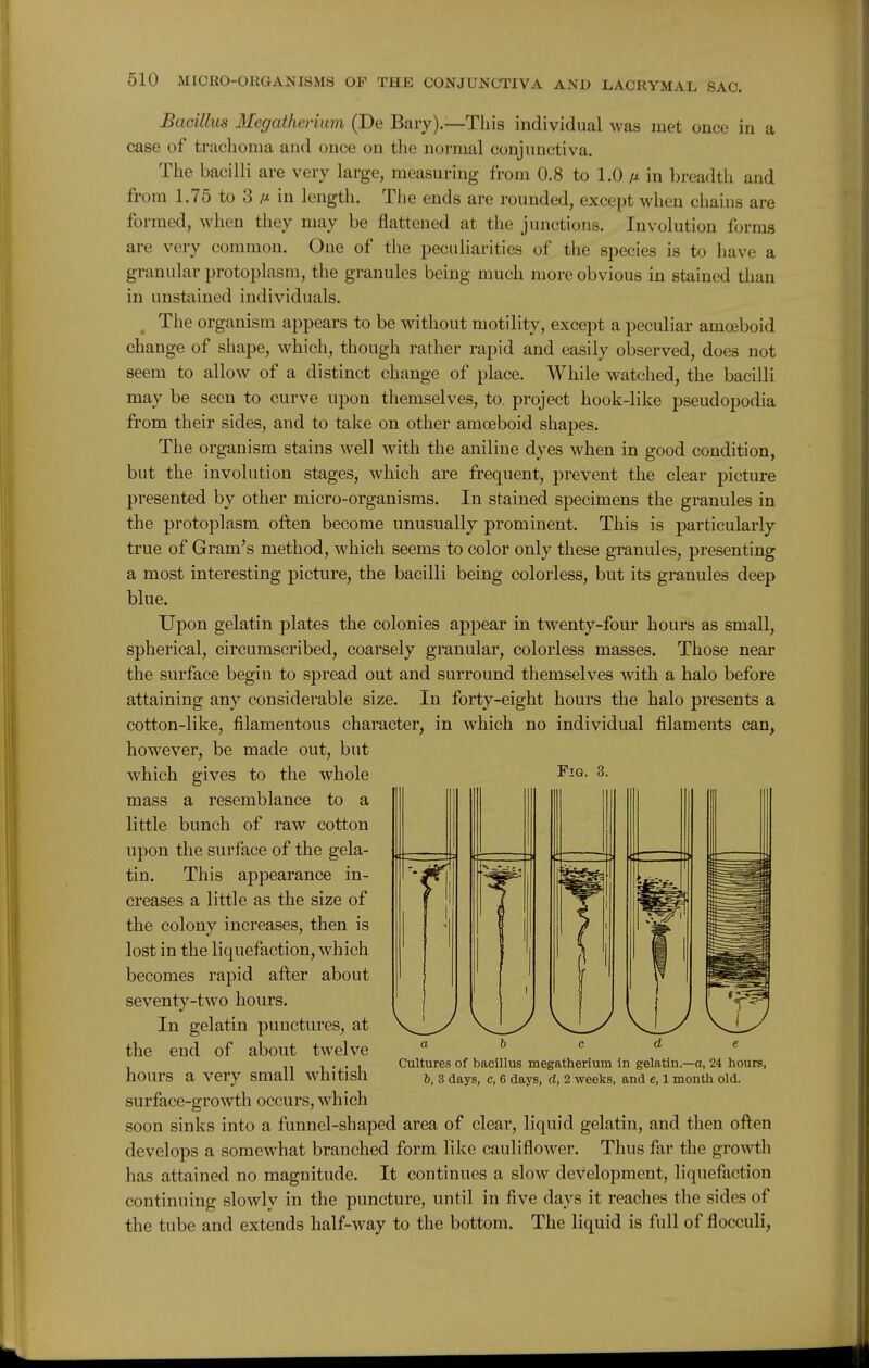 Bacillus Megatherium (De Bary).—This individual was met once in a case of trachoma and once on the normal conjunctiva. The bacilli are very large, measuring from 0.8 to 1.0 m in breatlth and from 1.75 to 3 a in length. The ends are rounded, except when chains are formed, when they may be flattened at the junctions. Involution forms are very common. One of the peculiarities of the species is to have a granular protoplasm, the granules being much more obvious in stained than in unstained individuals. ^ The organism appears to be without motility, except a peculiar amoeboid change of shape, which, though rather rapid and easily observed, does not seem to allow of a distinct change of place. While watched, the bacilli may be seen to curve upon themselves, to. project hook-like pseudopodia from their sides, and to take on other amoeboid shapes. The organism stains well with the aniline dyes when in good condition, but the involution stages, which are frequent, prevent the clear picture presented by other micro-organisms. In stained specimens the granules in the protoplasm often become unusually prominent. This is particularly true of Gram's method, which seems to color only these granules, presenting a most interesting picture, the bacilli being colorless, but its granules deep blue. Upon gelatin plates the colonies appear in twenty-four hours as small, spherical, circumscribed, coarsely granular, colorless masses. Those near the surface begin to spread out and surround themselves with a halo before attaining any considerable size. In forty-eight hours the halo presents a cotton-like, filamentous character, in which no individual filaments can, however, be made out, but which gives to the whole mass a resemblance to a little bunch of raw cotton upon the surface of the gela- tin. This appearance in- creases a little as the size of the colony increases, then is lost in the liquefaction, which becomes rapid after about seventy-two hours. In gelatin punctures, at the end of about twelve hours a very small whitish surface-growth occurs, which soon sinks into a funnel-shaped area of clear, liquid gelatin, and then often develops a somewhat branched form like cauliflower. Thus far the growth has attained no magnitude. It continues a slow development, liquefaction continuing slowly in the puncture, until in five days it reaches the sides of the tube and extends half-way to the bottom. The liquid is full of flocculi. Fig. 3. abode Cultures of bacillus megatherium in gelatin.—o, 24 hours, b, 3 days, c, 6 days, d, 2 weeks, and e, 1 month old.