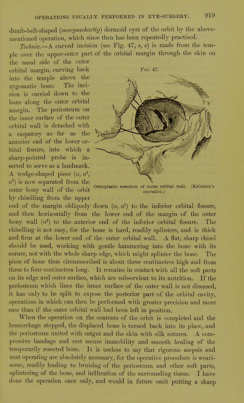 Osteoplastic resection of outer orbital wall, operation.) (Kronlein's dumb-bell-shaped (zw&ysackartig) dermoid cyst of the orbit by the above- mentioned operation, which since then has been repeatedly practised. Technic.—A curved incision (see Fig. 47, s, s) is made from the tem- ple over the upper-outer part of the orbital margin through tlie skin on the nasal side of the outer orbital margin, curving back Fig. 47. into the temple above the zygomatic bone. The inci- sion is carried down to the bone along the outer orbital margin. The periosteum on the inner surface of the outer orbital wall is detached with a raspatory as far as the anterior end of the lower or- bital fissure, into which a sharp-pointed probe is in- serted to serve as a landmark. A wedge-shaped piece (a, a^, a^) is now separated from the outer bony wall of the orbit by chiselling from the upper end of the margin obliquely down (a, o}) to the inferior orbital fissure, and then horizontally from the lower end of the margin of the outer bony wall {aF) to the anterior end of the inferior orbital fissure. The chiselling is not easy, for the bone is hard, readily splinters, and is thick and firm at the lower end of the outer orbital wall. A flat, sharp chisel should be used, working with gentle hammering into the bone with its corner, not with the whole sharp edge, which might splinter the bone. The piece of bone thus circumscribed is about three centimetres high and from three to four centimetres long. It remains in contact with all the soft parts on its edge and outer surface, which are subservient to its nutrition. If the periosteum which lines the inner surface of the outer wall is not diseased, it has only to be split to expose the posterior part of the orbital cavity, operations in which can then be performed with greater precision and more ease than if the outer orbital wall had been left in position. When the operation on the contents of the orbit is completed and the hemorrhage stopped, the displaced bone is turned back into its place, and the periosteum united with catgut and the skin with silk sutures. A com- pressive bandage and rest secure immobility and smooth healing of the temporarily resected bone. It is useless to say that rigorous asepsis and neat operating are absolutely necessary, for the operative procedure is weari- some, readily leading to bruising of the periosteum and other soft parts, splintering of the bone, and infiltration of the surrounding tissue. I have done the operation once only, and would in future omit putting a sharp