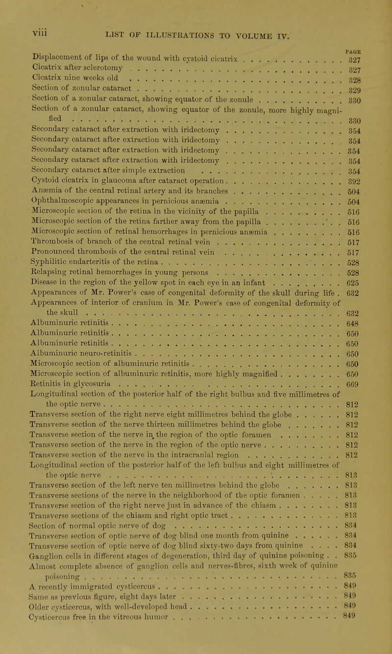 _,. PAGE Displacement of lips of the wound with cystoid cicatrix 327 Cicatrix after sclerotomy 327 Cicatrix nine weeks old 328 Section of zonular cataract 329 Section of a zonular cataract, showing equator of the zonule 330 Section of a zonular cataract, showing equator of the zonule, more highly magni- fied 330 Secondary cataract after extraction with iridectomy 354 Secondary cataract after extraction with iridectomy 354 Secondary cataract after extraction with iridectomy 354 Secondary cataract after extraction with iridectomy 354 Secondary cataract after simple extraction 354 Cystoid cicatrix in glaucoma after cataract operation 392 Ansemia of the central retinal artery and its branches 504 Ophthalmoscopic appearances in pernicious anaemia 504 Microscopic section of the retina in the vicinity of the papilla 516 Microscopic section of the retina farther away from the papilla ' . . 516 Microscopic section of retinal hemorrhages in pernicious ansemia 516 Thrombosis of branch of the central retinal vein 517 Pronounced thrombosis of the central retinal vein 517 Syphilitic endarteritis of the retina ' . . . , 528 Eelapsing retinal hemorrhages in young persons 528 Disease in the region of the yellow spot in each eye in an infant 625 Appearances of Mr. Power's case of congenital deformity of the skull during life . 632 Appearances of interior of cranium in Mr. Power's case of congenital deformity of the skull 632 Albuminuric retinitis 648 Albuminuric retinitis 650 Albuminuric retinitis 650 Albuminuric neuro-retinitis 650 Microscopic section of albuminuric retinitis 650 Microscopic section of albuminuric retinitis, more highly magnified 650 Ketinitis in glycosuria 669 Longitudinal section of the posterior half of the right bulbus and five millimetres of the optic nerve 812 Transverse section of the right nerve eight millimetres behind the globe 812 Transverse section of the nerve thirteen millimetres behind the globe 812 Transverse section of the nerve in the region of the optic foramen 812 Transverse section of the nerve in the region of the optic nerve 812 Transverse section of the nerve in the intracranial region 812 Longitudinal section of the posterior half of the left bulbus and eight millimetres of tlie optic nerve ' 813 Transverse section of the left nerve ten millimetres behind the globe 813 Transverse sections of the nerve in the neighborhood of the optic foramen 813 Transverse section of the right nerve just in advance of the chiasm 813 Transverse sections of the chiasm and right optic tract 813 Section of normal optic nerve of dog 834 Transverse section of optic nerve of dog blind one month from quinine 834 Transverse section of optic nerve of dog blind sixty-two days from quinine .... 834 Ganglion cells in different stages of degeneration, third day of quinine poisoning . . 835 Almost complete absence of ganglion cells and nerves-fibres, sixth week of quinine poisoning . . . ■ 835 A recently immigrated cysticercus 849 Same as previous figure, eight days later 849 Older cysticercus, with well-developed head 849 Cysticercus free in the vitreous humor 849