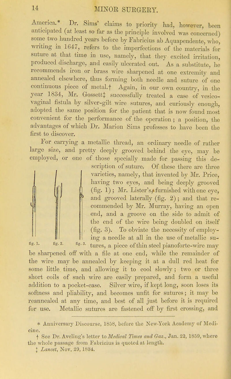 America.* Dr. Sims' claims to priority had, however, been anticipated (at least so far as the principle involved was concerned) some two hundred years before by Fabricius ab Aquapendente, who, writing in 1647, refers to the imperfections of the materials for suture at that time in use, namely, that they excited irritation, produced discharge, and easily ulcerated out. As a substitute, he recommends ii-on or brass wire sharpened at one extremity and annealed elsewhere, thus forming both needle and suture of one continuous piece of metal.f Again, in our own country, in the year 1834, Mr. Gossettf successfully treated a case of vesico- vaginal fistula by silver-gilt wire sutures, and curiously enough, adopted the same position for the patient that is now found most convenient for the performance of the operation; a position, the advantages of which Dr. Marion Sims professes to have been the first to discover. For carrying a metallic tlu'ead, an ordinary needle of rather large size, and pretty deeply grooved behind the eye, may be employed, or one of those specially made for passing this de- scription of suture. Of these there are three I varieties, namely, that invented by Mr. Price, 1 ha^'ing two eyes, and being deeply grooved [ (fig. 1); Mr. Lister's,* furnished with one eye, and grooved laterally (fig. 2) ; and that re- commended by Mr. Murray, having an open end, and a groove on the side to admit of the end of the wire being doubled on itself (fig. 3). To obviate the necessity of employ- I'l ing a needle at all in the use of metallic su- ■ ^ tures, a piece of thin steel pianoforte-wire may be sharpened off with a file at one end, while the remainder of the wire may be annealed by keeping it at a dull red heat for some little time, and allowing it to cool slowly; two or three short coils of such wire are easily prepared, and form a useful addition to a pocket-case. Silver wire, if kept long, soon loses its softness and pliability, and becomes unfit for sutures; it may be reannealed at any time, and best of all just before it is required for use. Metallic sutm-es are fastened off by first crossing, and * Anuiversary Uiacourse, 1858, before the New-York Acadcmj- of Medi- cine. f See Dr. Avelinpt's letter to Medical Times and Oaz., Jan. 22, 1859, where the wliole passage from Fabricius is quoted at length. + Lancet, Nov. 29, 18^4.