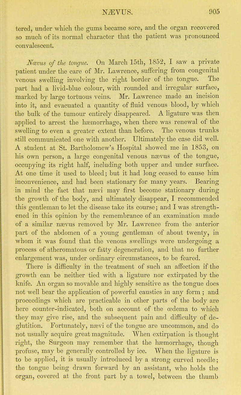 tered, under wliicli the gums became sore, and the organ recovered so much of its normal character that the patient was pronounced convalescent. Ncevus of the tongue. On Mai'ch 15th, 1852, I saw a private patient under the care of Mr. Lawrence, suffering from congenital venous swelling involving the right border of the tongue. The part had a livid-blue colour, with rounded and irregiilar sm'face, marked by large tortuous veins. Mr. Lawrence made an incision into it, and evacuated a quantity of fluid venous blood, by which the bulk of the tumour entirely disappeared. A ligatru'e was then applied to arrest the haemorrhage, when there was renewal of the sweUina: to even a greater extent than before. The venous trunks still communicated one with another. Ultimately the case did well. A student at St. Bartholomew's Hospital showed me in 1853, on his own person, a large congenital venous nsevus of the tongue, occupying its right half, including both upper and under surface. At one time it used to bleed; but it had long ceased to cause him inconvenience, and had been stationary for many years. Bearing in mind the fact that njBvi may first become stationary during the growth of the body, and ultimately disappear, I recommended this gentleman to let the disease take its course; and I was strength- ened in this opinion by the remembrance of an examination made of a similar nsevus removed by Mr. Lawi'ence from the anterior part of the abdomen of a young gentleman of about twenty, in whom it was found that the venous swellings were undergoing a process of atheromatous or fatty degeneration, and that no further enlargement was, under ordinary circumstances, to be feared. There is difficulty in the treatment of such an affection if the growth can be neither tied with a ligature nor extirpated by the knife. An organ so movable and highly sensitive as the tongue does not well bear the application of powerful caustics in any form ; and proceedings which are practicable in other parts of the body are here counter-indicated, both on accomit of the oedema to which they may give rise, and the subsequent pain and difficulty of de- glutition. Fortunately, ntevi of the tongue are uncommon, and do not usually acquire great magnitude. When extirpation is thought right, the Sm'geon may remember that the hsemorrhage, though profuse, may be generally controlled by ice. When the ligature is to be applied, it is usually introduced by a strong curved needle; the tongue being drawn forward by an assistant, who holds the organ, covered at the front part by a towel, between the thumb