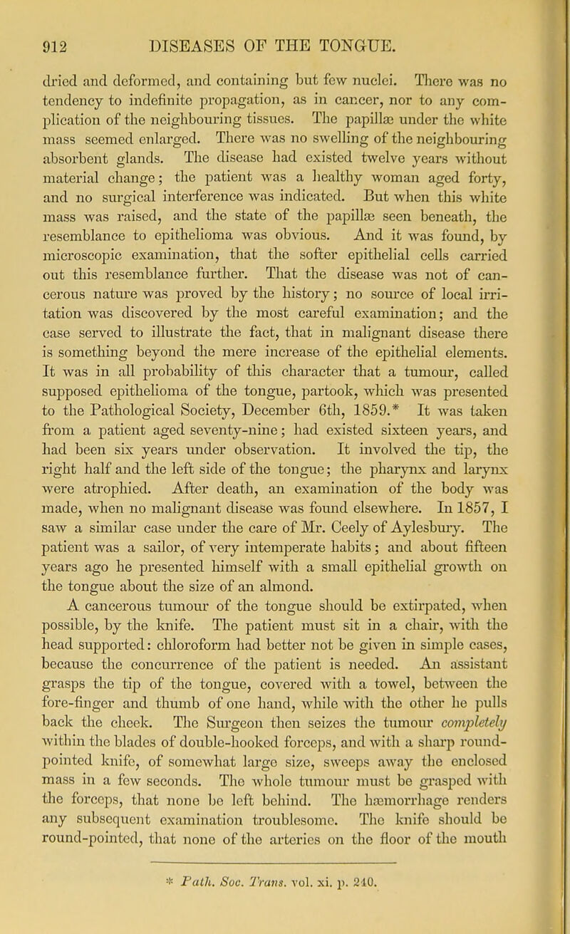 dried and deformed, and containing but few nuclei. Tliere was no tendency to indefinite propagation, as in cancer, nor to any com- plication of the neighbouring tissues. The papilla; under the white mass seemed enlai'ged. There was no sweUing of the neighbouring absorbent glands. The disease had existed twelve years without material change; the patient was a healthy woman aged forty, and no surgical interference was indicated. But when this white mass was raised, and the state of the papillae seen beneath, the resemblance to epithelioma was obvious. And it was foimd, by microscopic examination, that the softer epithelial cells carried out this resemblance further. That the disease was not of can- cerous nature was proved by the history; no source of local irri- tation was discovered by the most careful examination; and the case served to illustrate the fact, that in malignant disease there is something beyond the mere increase of the epithelial elements. It was in all probability of tliis character that a tumour, called supposed epithelioma of the tongue, partook, which was presented to the Pathological Society, December 6th, 1859.* It was taken from a patient aged seventy-nine; had existed sixteen yeai's, and had been six years under observation. It involved the tip, the right half and the left side of the tongue; the pharynx and larynx were atrophied. After death, an examination of the body was made, when no malignant disease was found elsewhere. In 1857, I saw a similar case under the care of Mr. Ceely of Aylesbmy. The patient was a sailor, of very intemperate habits; and about fifteen years ago he presented himself with a small epithelial growth on the tongue about the size of an almond. A cancerous tumour of the tongue should be extirpated, when possible, by the knife. The patient must sit in a chair, with the head supported: chloroform had better not be given in simple cases, because the concurrence of the patient is needed. An assistant grasps the tip of the tongue, covered with a towel, between the fore-finger and thumb of one hand, while with the other he pulls back the check. The Sm-geon then seizes the tumour completely within the blades of double-hooked forceps, and with a shai'p round- pointed knife, of somewhat large size, sweeps away the enclosed mass in a few seconds. The whole tumour must be grasped with the forceps, that none be left behind. The haamorrhage renders any subsequent examination troublesome. The knife should be round-pointed, that none of the arteries on the floor of the mouth * Path. SoG. Tram. vol. xi. p. 240.