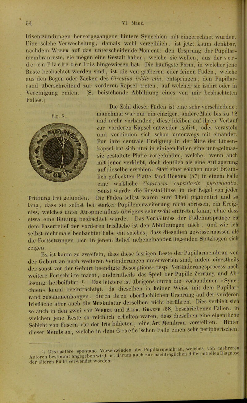 IdsentzUndungen hervorgegangene hintere Synechien mit eingerechnet wurdeii. Eine solche Verwechslung, damals wohl verzeihlich, ist jetzt kaum denkbar, nachdem Wkbku auf das unterscheidende Moment: den Ursprung der Pupillar- membranresle, sie mögen eine Gestalt haben , welche sie wollen, aus der vor- der e n F1 ä c h e d e r I ri s hingewiesen hat. Die häufigste Form, in welcher jene Reste beobachtet worden sind, ist die von gröberen oder feinen Fäden, welche aus den Bogen oder Zacken des Circulus iridis min. entspringen, den Pupillar- rand überschreitend zur vorderen Kapsel treten, auf welcher sie isolirt oder in Vereinigung enden. (S. beistehende Abbildung eines von mir beobachteten Falles.)' Die Zahl dieser Fäden ist eine sehr verschiedene; manchmal war nur ein einziger, andere Male bis zu 12 und mehr vorhanden; diese bleiben auf ihren Verlauf zur vorderen Kapsel entweder isolirt, ocTer verästeln und verbinden sich schon unterwegs mit einander. Ftir ihre centrale Endigung in der Mitte der Linsen- kapsel hat sich nun in einigen Fällen eine unregelmäs- sig gestaltete Platte vorgefunden, welche, wenn auch mit jener verklebt, doch deuthch als eine Auflagerung auf dieselbe erschien. Statt einer solchen meist bräun- lich gefleckten Platte fand Horner (57) in einem Falle eine wirkliche Cataracta capsularis pyramidalis. Sonst wurde die KrystalUinse in der Regel von jeder Trübung frei gefunden. Die Fäden selbst waren zum Theil pigmentirt und so lang, dass sie selbst bei starker Pupillenerweiterung nicht abrissen, ein Ereig- niss, welches unter Atropineinfluss übrigens sehr wohl eintreten kann, ohne dass etwa eine Blutung beobachtet w^urde. Das Verhältniss der Fädenursprünge zu dem Faserrelief der vorderen Irisfläche ist den Abbildungen nach , und wie ich selbst mehrmals beobachtet habe ein solches, dass dieselbeü gewissermassen als die Fortsetzungen der in jenen) Relief nebeneinandec liegenden Spitzbogen sich zeigen. Es. ist kaum zu zweifeln, dass diese fasrigeu Reste der Pupillarmembran von der Geburt an noch weiteren Veränderungen unterworfen sind, indem einestheils der sonst vor der Geburt beendigte Resorptions- resp. Veränderungsprocess noch weitere Fortschritte macht, anderntheils das Spiel der Pupille Zerrung und Ab- lösung herbeiführt, i) Das letztere ist übrigens durch die vorhandenen »Syne- chien« kaum beeinträchtigt, da dieselben in keiner Weise mit dem Pupillar- rand zusammenhängen , durch ihren oberflächlichen Ursprung auf der vorderen Irisfläche aber auch die Muskulatur derselben nicht berühren. Dies verhielt sich so auch in den zwei von Weber und Alfr. Graefe (58j beschriebenen Fällen, in w elchen jene Reste so reichlich erhalten waren, dass dieselben eine eigenlliche Schicht von Fasern vor der Iris bildeten, eine Art Membran vorstellten. Hinter dieser Membran, welche in dem Graefe'schen Falle einen sehr peripherischen. 1 n«««nntprp sDontane Verschwinden der Pupillarmembran, welches von mehreren Au.ore'n b^t^mmt ang^gS^^^^^ auch zuV nachträglichen differentiellen Diagnose der älteren Falle verwendet worden.