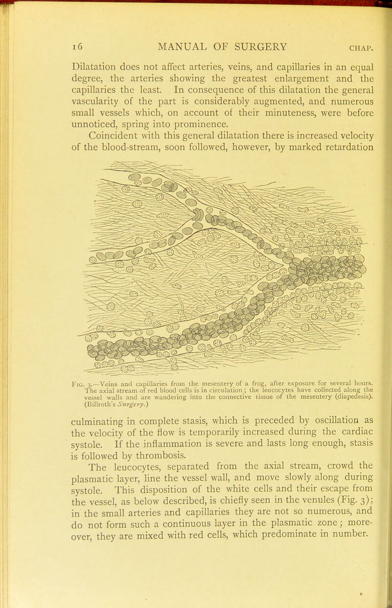 Dilatation does not affect arteries, veins, and capillaries in an equal degree, the arteries showing the greatest enlargement and the ; capillaries the least. In consequence of this dilatation the general ] vascularity of the part is considerably augmented, and numerous •■ small vessels which, on account of their minuteness, were before i unnoticed, spring into prominence. j Coincident with this general dilatation there is increased velocity of the blood-stream, soon followed, however, by marked retardation 1 Fig. 3.—Veins anil capillaries from the mesentery of a frog, after exposure for several hotirs. The axial stream of red blood cells is in circulation ; the leucocytes have collected along the vessel walls and are wandering into the connective tissue of the mesentery (diapedesis). (Billroth's Surgery.) culminating in complete stasis, which is preceded by oscillation as the velocity of the flow is temporarily increased during the cardiac systole. If the inflammation is severe and lasts long enough, stasis is followed by thrombosis. The leucocytes, separated from the axial stream, crowd the plasmatic layer, line the vessel wall, and move slowly along during systole. This disposition of the white cells and their escape from the vessel, as below described, is chiefly seen in the venules (Fig. 3); in the small arteries and capillaries they are not so numerous, and do not form such a continuous layer in the plasmatic zone; more- over, they are mixed with red cells, which predominate in number. U