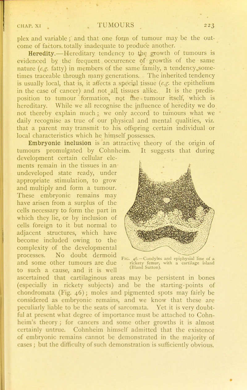 plex and variable; and that one fomi of tumour may be the out- come of factors, totally inadequate to produce another. Heredity.—Hereditary tendency to \J^e growth of tumours is evidenced by the frequent occurrence of growths of the same nature (e.g. fatty) in members of the same family, a tendency.some- times traceable through many generations. The inherited tendency is usually local, that is, it affects a speci*il tissue (e.g. the epithelium in the case of cancer) and not ^all tissues alike. It is the predis- position to tumour formation, ngt ftie - tumour itself, which is hereditary. While we all recognise the influence of heredity we do not thereby explain much; we only accord to tumours what we daily recognise as true of our physical and mental qualities, viz. that a parent may transmit to his offspring certain individual or local characteristics which he himself possesses. Embryonic inclusion is an attractive theory of the origin of tumours promulgated by Cohnheim. It suggests that during development certain cellular ele- ments remain in the tissues in an undeveloped state ready, under appropriate stimulation, to grow and multiply and form a tumour. These embryonic remains may have arisen from a surplus of the cells necessary to form the part in which they lie, or by inclusion of cells foreign to it but normal to adjacent structures, which have become included owing to the complexity of the developmental processes. No doubt dermoid „ ^ ^ , , . -^T—^, ,• tic. 46. —Condyles and epiphysial line of a and some other tumours are due . Hckety femur, with a canilage island 1 1 v • 11 (Bland Sutton). to such a cause, and it is well ascertained that cartilaginous areas may be persistent in bones (especially in rickety subjects) and be the starting-points of chondromata (Fig. 46); moles and pigmented spots may fairly be considered as embryonic remains, and we know that these are pecuMarly liable to be the seats of sarcomata. Yet it is very doubt- ful at present what degree of importance must be attached to Cohn- heim's theory ; for cancers and some other growths it is almost certainly untrue. Cohnheim himself admitted that the existence of embryonic remains cannot be demonstrated in the majority of cases ; but the difficulty of such demonstration is sufficiently obvious.