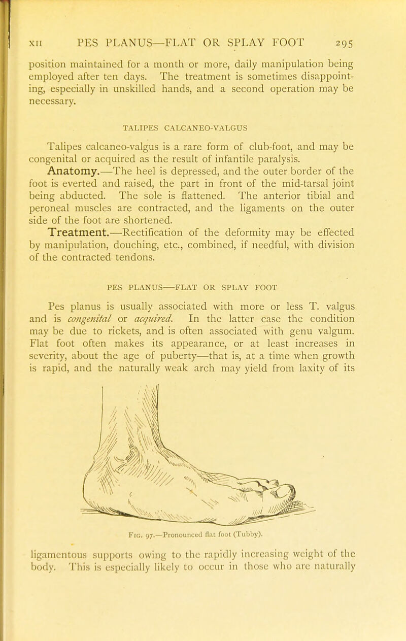 position maintained for a month or more, daily manipulation being employed after ten days. The treatment is sometimes disappoint- ing, especially in unskilled hands, and a second operation may be necessary. TALIPES CALCANEO-VALGUS Talipes calcaneo-valgus is a rare form of club-foot, and may be congenital or acquired as the result of infantile paralysis. Anatomy.—The heel is depressed, and the outer border of the foot is everted and raised, the part in front of the mid-tarsal joint being abducted. The sole is flattened. The anterior tibial and peroneal muscles are contracted, and the ligaments on the outer side of the foot are shortened. Treatment,—Rectification of the deformity may be effected by manipulation, douching, etc., combined, if needful, with division of the contracted tendons. PES PLANUS FLAT OR SPLAY FOOT Pes planus is usually associated with more or less T. valgus and is cotigenital or acquired. In the latter case the condition may be due to rickets, and is often associated with genu valgum. Flat foot often makes its appearance, or at least increases in severity, about the age of puberty—that is, at a time when growth is rapid, and the naturally weak arch may yield from laxity of its Fig. 97.—PronounceJ flat foot (Tiiljliy). ligamentous supports owing to the rapidly increasing wcigiit of the body. This is especially likely to occur in those who are naturally