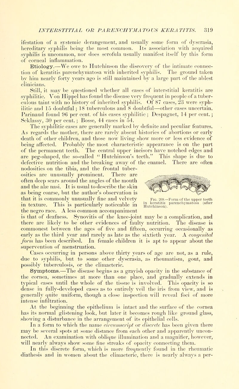 ifestation of a systemic derangement, and usually some form of dyscrasia, hereditary syphilis being the most common. Its association with acquired syphilis is uncommon, nor does scrofula usually manifest itself by this form of corneal inflammation. Etiology.—We owe to Hutchinson the discovery of the intimate connec- tion of keratitis parenchymatosa with inherited syphilis. The ground taken bv him nearly forty years ago is still maintained by a large part of tiie ablest clinicians. Still, it may be questioned whether all cases of interstitial keratitis are syphilitic. Von Hippel has found the disease very frequent in people of a tuber- culous taint with no history of inherited syphilis. Of 87 cases, 23 were syph- ilitic and 15 doubtful; 18 tuberculous and 8 doubtful—other cases uncertain. Parinaud found 96 per cent, of his cases syphilitic ; Despagnet, 14 per cent.; Scklassy, 30 per cent.; Bosse, 44 cases in 54. The syphilitic cases are generally marked by definite and peculiar features. As regards the mother, there are rarely absent histories of abortions or early ■death of other children, and those now living show more or less evidence of being affected. Probably the most characteristic appearance is on the part of the permanent teeth. The central upper incisors have notched edges and are peg-shaped, the so-called  Hutchinson's teeth. This shape is due to defective nutrition and the breaking away of the enamel. There are often nodosities on the tibia, and the frontal tuber- osities are unusually prominent. There are often deep scars around the angles of the mouth and the alse nasi. It is usual to describe the skin as being coarse, but the author's observation is that it is commonly unusually fine and velvety fig. 209.—Form of the upper teeth in texture. This is particularly noticeable in gutctS£on). Parench>'matosa <after the negro race. A less common accompaniment is that of deafness. Synovitis of the knee-joint may be a complication, and there are likely to be other evidences of faulty nutrition. The disease is commonest between the ages of five and fifteen, occurring occasionally as early as the third year and rarely as late as the sixtieth year. A congenital form has been described. In female children it is apt to appear about the supervention of menstruation. Cases occurring in persons above thirty years of age are not, as a rule, due to syphilis, but to some other dyscrasia, as rheumatism, gout, and possibly tuberculosis, or the climacteric. Symptoms.—The disease begins as a grayish opacity in the substance of the cornea, sometimes at more than one place, and gradually extends in typical cases until the whole of the tissue is involved. This opacity is so dense in fully-developed cases as to entirely veil the iris from view, and is generally quite uniform, though a close inspection will reveal foci of more intense infiltration. At the beginning the epithelium is intact and the surface of the cornea has its normal glistening look, but later it becomes rough like ground glass, .showing a disturbance in the arrangement of its epithelial cells. In a form to which the name oircumscript or discrete has been given there may be several spots at some distance from each other and apparently uncon- nected. An examination with oblique illumination and a magnifier, however, will nearly always show some fine streaks of opacity connecting them. In this discrete form, which is more frequently found in the rheumatic diathesis and in women about the climacteric, there is nearly always a per-