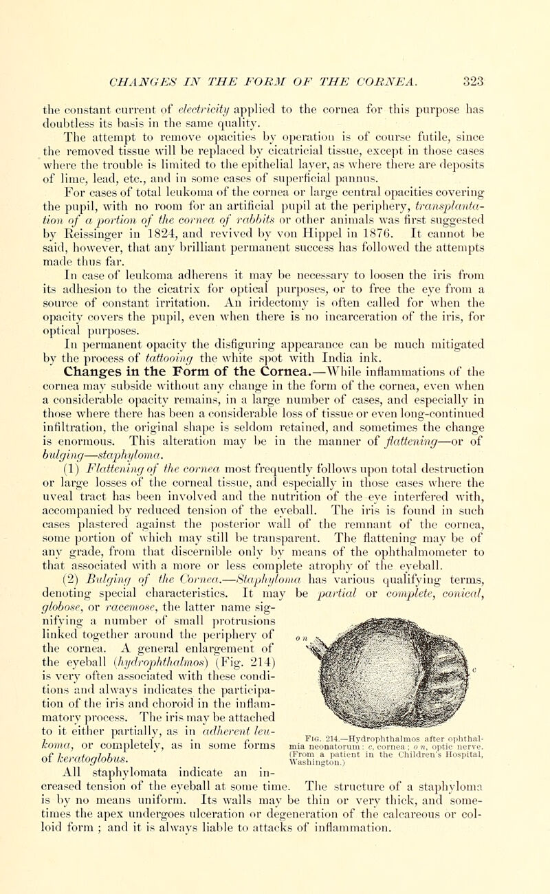 the constant current of electricity applied to the cornea for this purpose has doubtless its basis in the same quality. The attempt to remove opacities by operation is of course futile, since the removed tissue will be replaced by cicatricial tissue, except in those cases where the trouble is limited to the epithelial layer, as where there are deposits of lime, lead, etc., and in some cases of superficial pannus. For cases of total leukoma of the cornea or large central opacities covering the pupil, with no room for an artificial pupil at the periphery, transplanta- tion of a'portion of the cornea of rabbits or other animals was first suggested by Reissinger in 1824, and revived by von Hippel in 1876. It cannot be said, however, that any brilliant permanent success has followed the attempts made thus far. In case of leukoma adherens it may be necessary to loosen the iris from its adhesion to the cicatrix for optical purposes, or to free the eye from a source of constant irritation. An iridectomy is often called for when the opacity covers the pupil, even when there is no incarceration of the iris, for optical purposes. In permanent opacity the disfiguring appearance can be much mitigated by the process of tattooing the white spot with India ink. Changes in the Form of the Cornea.—While inflammations of the cornea may subside without any change in the form of the cornea, even when a considerable opacity remains, in a large number of cases, and especially in those where there has been a considerable loss of tissue or even long-continued infiltration, the original shape is seldom retained, and sometimes the change is enormous. This alteration may be in the manner of flattening—or of bulging—staphyloma. (1) Flattening of the cornea most frequently follows upon total destruction or large losses of the corneal tissue, and especially in those cases where the uveal tract has been involved and the nutrition of the eye interfered with, accompanied by reduced tension of the eyeball. The iris is found in such cases plastered against the posterior wall of the remnant of the cornea, some portion of which may still be transparent. The flattening may be of any grade, from that discernible only by means of the ophthalmometer to that associated with a more or less complete atrophy of the eyeball. (2) Bulging of the Cornea,.—Staphyloma has various qualifying terms, denoting special characteristics. It may be partial or complete, conical, globose, or racemose, the latter name sig- nifying a number of small protrusions linked together around the periphery of 0 the cornea. A general enlargement of the eyeball (hydrophthalmos) (Fig. 214) is very often associated with these condi- tions and always indicates the participa- tion of the iris and choroid in the inflam- matory process. The iris may be attached to it either partially, as in adherent leu- , l i i ■ t> Fig. 214—Hvilmi.hthiilmns tinVr ophthal- KOma, Or completely, as in some forms mia neonatorum: c, cornea; o n, optic nerve. of keratoglobus.  SnlXf* ln the chil(lren's Hospita1' All staphylomata indicate an in- creased tension of the eyeball at some time. The structure of a staphyloma is by no means uniform. Its walls may be thin or very thick, and some- times the apex undergoes ulceration or degeneration of the calcareous or col- loid form ; and it is always liable to attacks of inflammation.