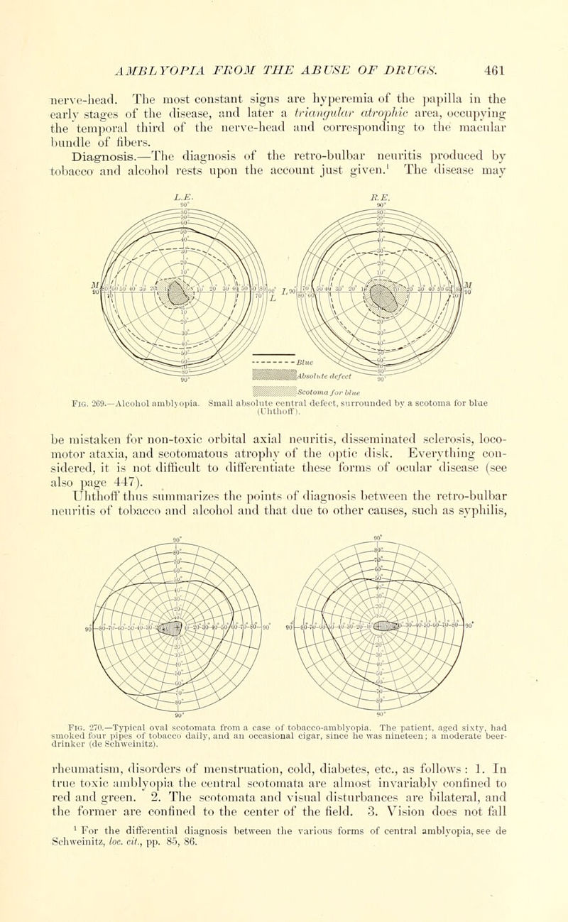 nerve-head. The most constant signs are hyperemia of the papilla in the early stages of the disease, and later a triangular atrophic area, occupying the temporal third of the nerve-head and corresponding to the macular bundle of libers. Diagnosis.—The diagnosis of the retro-bulbar neuritis produced by tobacco and alcohol rests upon the account just given.' The disease may !::;: 'Scotoma fur blue Fig. 269.—Alcohol amblyopia. Small absolute central defect, surrounded by a scotoma for blue be mistaken for non-toxic orbital axial neuritis, disseminated sclerosis, loco- motor ataxia, and scotomatous atrophy of the optic disk. Everything con- sidered, it is not difficult to differentiate these forms of ocular disease (see also page 447). Uhthoff thus summarizes the points of diagnosis between the retro-bulbar neuritis of tobacco and alcohol and that due to other causes, such as syphilis, Fig. 270.—Typical oval scotomata from a case of tobaceo-umblyopia. The patient, aged sixty, had smoked four pipes of tobacco daily, and an occasional cigar, since he was nineteen; a moderate beer- drinker (de Schweinitz). rheumatism, disorders of menstruation, cold, diabetes, etc., as follows : 1. In true toxic amblyopia the central scotomata are almost invariably confined to red and green. 2. The scotomata and visual disturbances are bilateral, and the former are confined to the center of the field. 3. Vision does not fall 1 For the differential diagnosis between the various forms of central amblyopia, see de Schweinitz, loc. cit., pp. 85, 86.