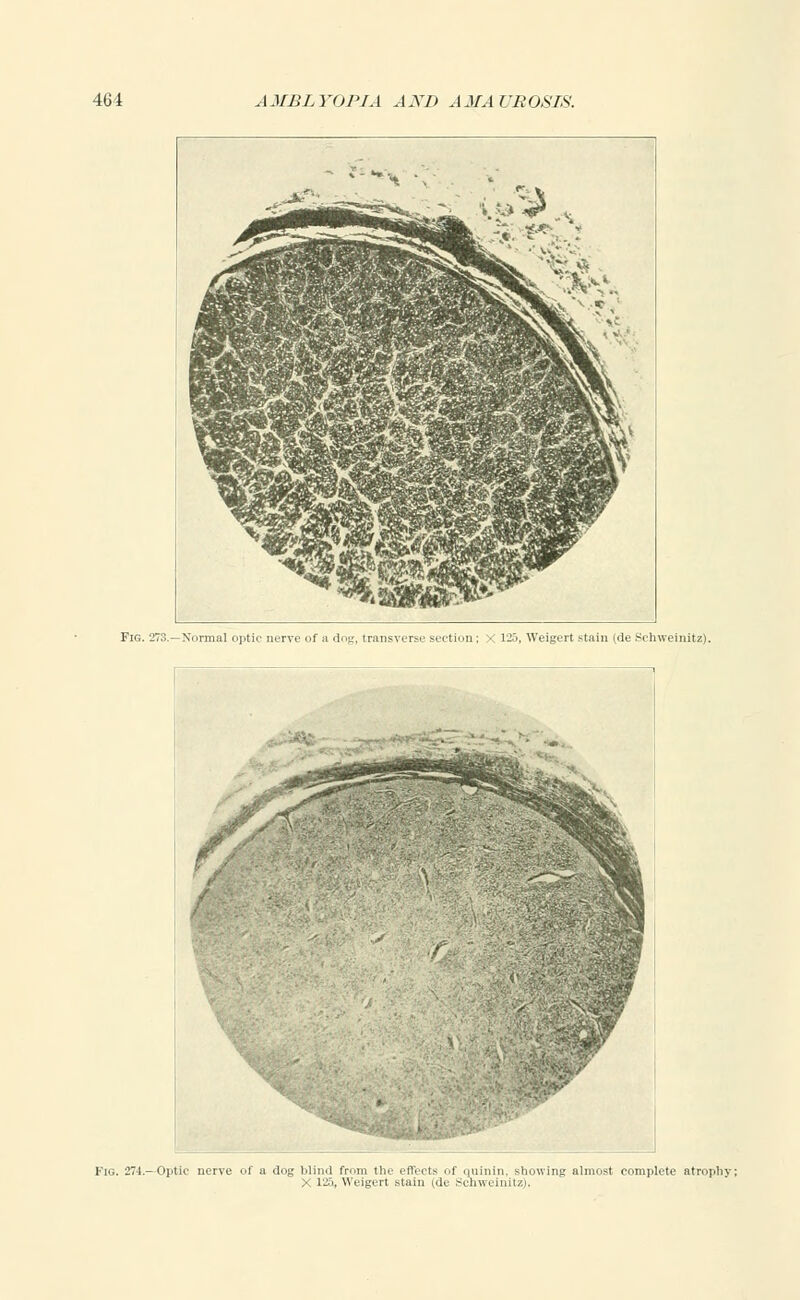 nin^vt ^^^w^^ftp-ls HnflBra&v J^^M^^^^^^^^ ^l&M^WlIm flKB^r A*-^ Fig. 273.—Xormal optic nerve of a dog, transverse section; X 125, Weigert stain (de Schweinitz). > 125, Weigert stain (de Schweinitz).