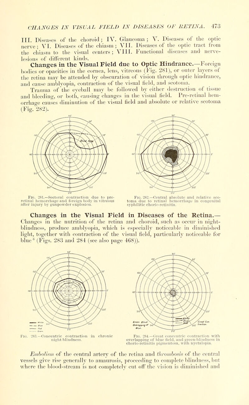 III. Diseases of the choroid ; IV. Glaucoma ; V. Diseases of the optic nerve; VI. Diseases of the chiasm; VII. Diseases of the optic tract from the chiasm to the visual centers ; VIII. Functional diseases and nerve- lesions of different kinds. Changes in the Visual Field due to Optic Hindrance.—Foreign bodies or opacities in the cornea, lens, vitreous (Fig. 281), or outer layers of the retina may be attended by obscuration of vision through optic hindrance, and cause amblyopia, contraction of the visual field, and scotoma. Trauma of the eyeball may be followed by either destruction _ of tissue and bleeding, or both, causing changes in the visual field. Pre-retinal hem- orrhage causes diminution of the visual field and absolute or relative scotoma (Fig. 282). Fig. 281.—Sectoral contraction due to pre- retinal hemorrhage and foreign body in vitreous after injury by gunpowder explosion. Fig. 282.—Central absolute and relative toma due to retinal hemorrhage in conger syphilitic chorio-retinitis. Changes in the Visual Field in Diseases of the Retina.— Changes in the nutrition of the retina and choroid, such as occur in night- blindness, produce amblyopia, which is especially noticeable in diminished light, together with contraction of the visual field, particularly noticeable for blue6 (Figs. 283 and 284 (see also page 468)). Fig. 2S1.—Great concentric contraction with overlapping of blue field, and green-blindness in chorio-retinitis pigmentosa, with nyctalopia. Embolism of the central artery of the retina and thrombosis of the central vessels give rise generally to amaurosis, proceeding to complete blindness, but where the blood-stream is not completely cut off the vision is diminished and