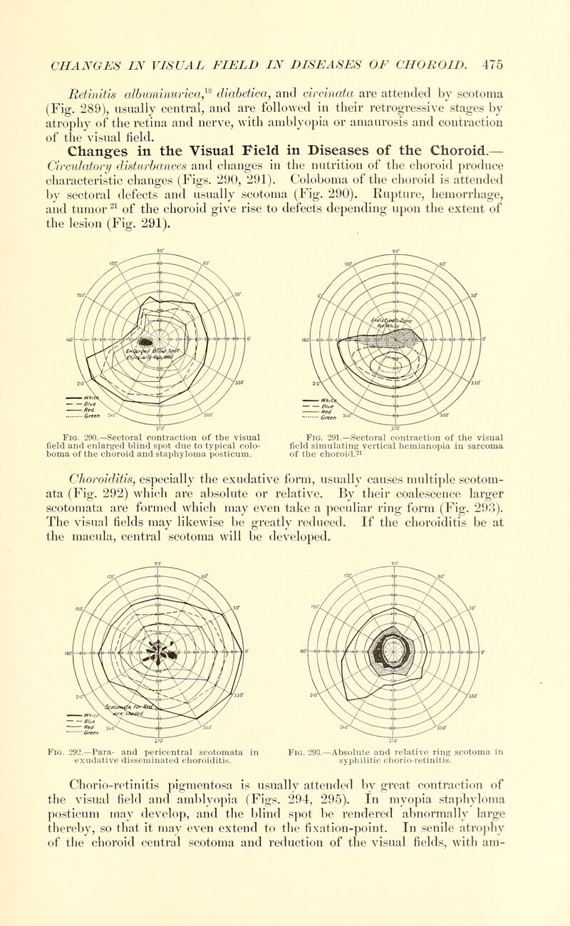 Retinitis albuminurica,13 diabetica, and eireinata are attended by scotoma (Fig. 289), usually central, and are followed in their retrogressive stages by atrophy of the retina and nerve, with amblyopia or amaurosis and contraction of the visual field. Changes in the Visual Field in Diseases of the Choroid.— Circulatory disturbances and changes in the nutrition of the choroid produce characteristic changes (Figs. 290, 291). Coloboma of the choroid is attended by sectoral defects and usually scotoma (Fig. 290). Rupture, hemorrhage, and tumor21 of the choroid give rise to defects depending upon the extent of the lesion (Fig. 291). Fig. 290.—Sectoral contraction of the visual field ami enlarged blind spot due to typical colo- boma of the choroid and staphyloma posticum. Fig. 291.—Sectoral contraction of the visual field simulating vertical hemianopia in sarcoma of the choroid.-1 Choroiditis, especially the exudative form, usually causes multiple scotom- ata (Fig. 292) which are absolute or relative. By their coalescence larger scotomata are formed which may even take a peculiar ring form (Fig. 293). The visual fields may likewise be greatly reduced. If the choroiditis be at the macula, central scotoma will be developed. -Absolute and relative ring scotoma in syphilitic chorio-retinitis. Chorio-retinitis pigmentosa is usually attended by great contraction of the visual field and amblyopia (Figs. 294, 295). In myopia staphyloma posticum may develop, and the blind spot be rendered abnormally large thereby, so that it may even extend to the fixation-point. In senile atrophy of the choroid central scotoma and reduction of the visual fields, with am-