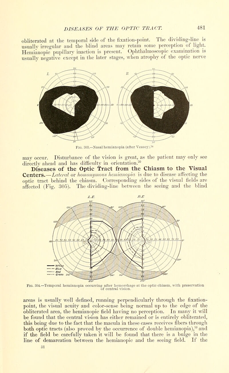 obliterated at the temporal side of the fixation-point. The dividing-line is usually irregular and the blind areas may retain some perception^ of light. Hemianopic pupillary inaction is present. Ophthalmoscopic examination is usually negative except in the later stages, when atrophy of the optic nerve Fig. 303.—Nasal hemianopia (after Veasey).14 may occur. Disturbance of the vision is great, as the patient may only see directly ahead and has difficulty in orientation.-0 Diseases of trie Optic Tract from the Chiasm to the Visual Centers.—Lateral or homonymous hemianopia is due to disease affecting the optic tract behind the chiasm. Corresponding sides of the visual fields are affected (Fig. 305). The dividing-line between the seeing and the blind areas is usually well defined, running perpendicularly through the fixation- point, the visual acuity and color-sense being normal up to the edge of the obliterated area, the hemianopic field having no perception. In many it will be found that the central vision has either remained or is entirely obliterated, this being due to the fact that the macula in these cases receives fibers through both optic tracts (also proved by the occurrence of double hemianopia),10 and if the field be carefully taken it will be found that there is a bulge in the line of demarcation between the hemianopic and the seeing field. If the 31