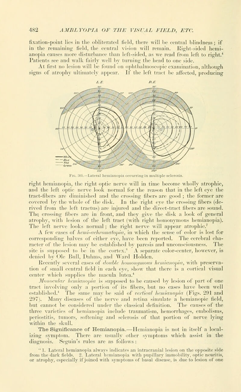 fixation-point lies in the obliterated field, there will be central blindness; if in the remaining field, the central vision will remain. Right-sided hemi- anopia causes more disturbance than left-sided, as we read from left to right.4 Patients see and walk fairly well by turning the head to one side. At first no lesion will be found on ophthalmoscopic examination, although signs of atrophy ultimately appear. If the left tract lie affected, producing Fig. 305.—Lateral heinianopia occurring in multiple sclerosis. right hemianopia, the right optic nerve will in time become wholly atrophic, and the left optic nerve look normal for the reason that in the left eye the tract-fibers are diminished and the crossing fibers are good ; the former are covered by the whole of the disk. In the right eye the crossing fibers (de- rived from the left tractus) tire injured and the direct-tract fibers are sound. The crossing fibers are in front, and they give the disk a look of general atrophy, with lesion of the left tract (with right homonymous hemianopia). The left nerve looks normal; the right nerve will appear atrophic.7 A few cases of hemir-aehromatopia, in which the sense of color is lost for corresponding halves of either eye, have been reported. The cerebral cha- racter of the lesion may be established by paresis and unconsciousness. The site is supposed to be in the cortex.8 A separate color-center, however, is denied by Ole Bull, Dahms, and Ward Holden. Recently several cases of double homonymous hemianopia, with preserva- tion of small central field in each eye, show that there is a cortical visual center which supplies the macula lutea.4 Monocular hemianopia is supposed to be caused by lesion of part of one tract involving only a portion of its fibers, but no cases have been well established.4 The same may lie said of vertical hemianopia (figs. 1291 and 297). Many diseases of the nerve and retina simulate a hemianopic field, but cannot be considered under the classical definition. The causes of the three varieties of hemianopia include traumatism, hemorrhages, embolisms, periostitis, tumors, softening and sclerosis of that portion of nerve lying within the skull. The Significance of Hemianopia.—Hemianopia is not in itself a local- izing symptom. There are usually other symptoms which assist in the diagnosis. Seguin's rules are as follow s :  1. Lateral hemianopia always indicates an intracranial lesion on the opposite side from the dark fields. 2. Lateral hemianopia with pupillary immobility, optic neuritis, or atrophy, especially if joined with symptoms of basal disease, is due to lesion of one