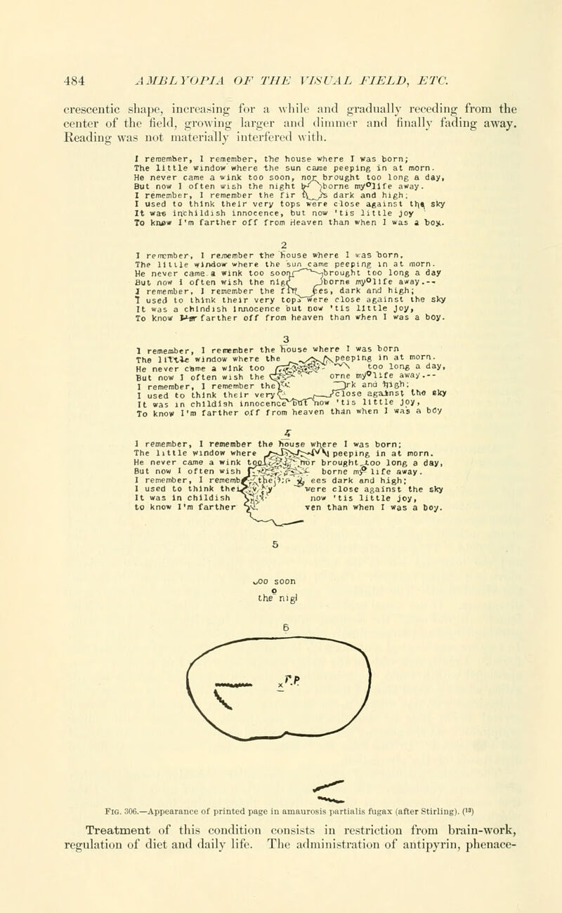 crescentic shape, increasing for a while and gradually receding from the center of the field, growing larger and dimmer and finally fading away. Reading was not materially interfered with. I remember, I remember, the house where I was born; The little window where the sun came peeping in at morn. He never came a wink too soon, nor brought too long a day, But now I often wish the night bJ^borne my°llfe away. I remember, I remember the fir t\^ys dark and high. I used to think their very tops were close against th,^ sky It wa« inchildish innocence, but now 'tis little joy To knew I'm farther off from Heaven than when 1 was a toy.. ise where I \ 'as oor n. !W :ame peeping in ^-jbrought too 1 Jborne my°llfe at i ong aw, a ay rn. day 1 remember, 1 remember the The Utile window where the He never came a wink too so But now I often wish the nl J remember, 1 remember the rrf? pes, dark and high; 7 used to think their very topVwere close against the sky It was a chlndish Innocence but oow 'tis little Joy, To know J*sr farther off from heaven than when I was a boy. the ho I remember indow where the --s^\peepln8 in at morn. ink too fT^SZW? ^ k°° lon6 a daV- ' my'life away.-- 1 remember The 1ITtle He never c' But now I often wish th I remember, I remember the)5< I used to think the! It was in childish innocenc To know I'm farther off from heaven than here I was born ~3rk and tjigh; ^__/close against the sky •' s little joy, nhen I was a boy 1 remember, I remember the house The little window wher He never came a wink But now I often wish I remember, I rememb I used to think the It was In childish to know I'm farther e I was born: peeping in at morn, .fror brought,too long a day, L>.*4 borne my* life away, j^ ees dark and high; * were close against the sky now 'tis little joy, ven than when I was a boy. v,oo soon p the nig! Fig. 306.—Appearance of printed page in amaurosis partialis fugax (after Stirling). () Treatment of this condition consists in restriction from brain-work, regulation of diet and daily life. The administration of antipyrin, phenace-